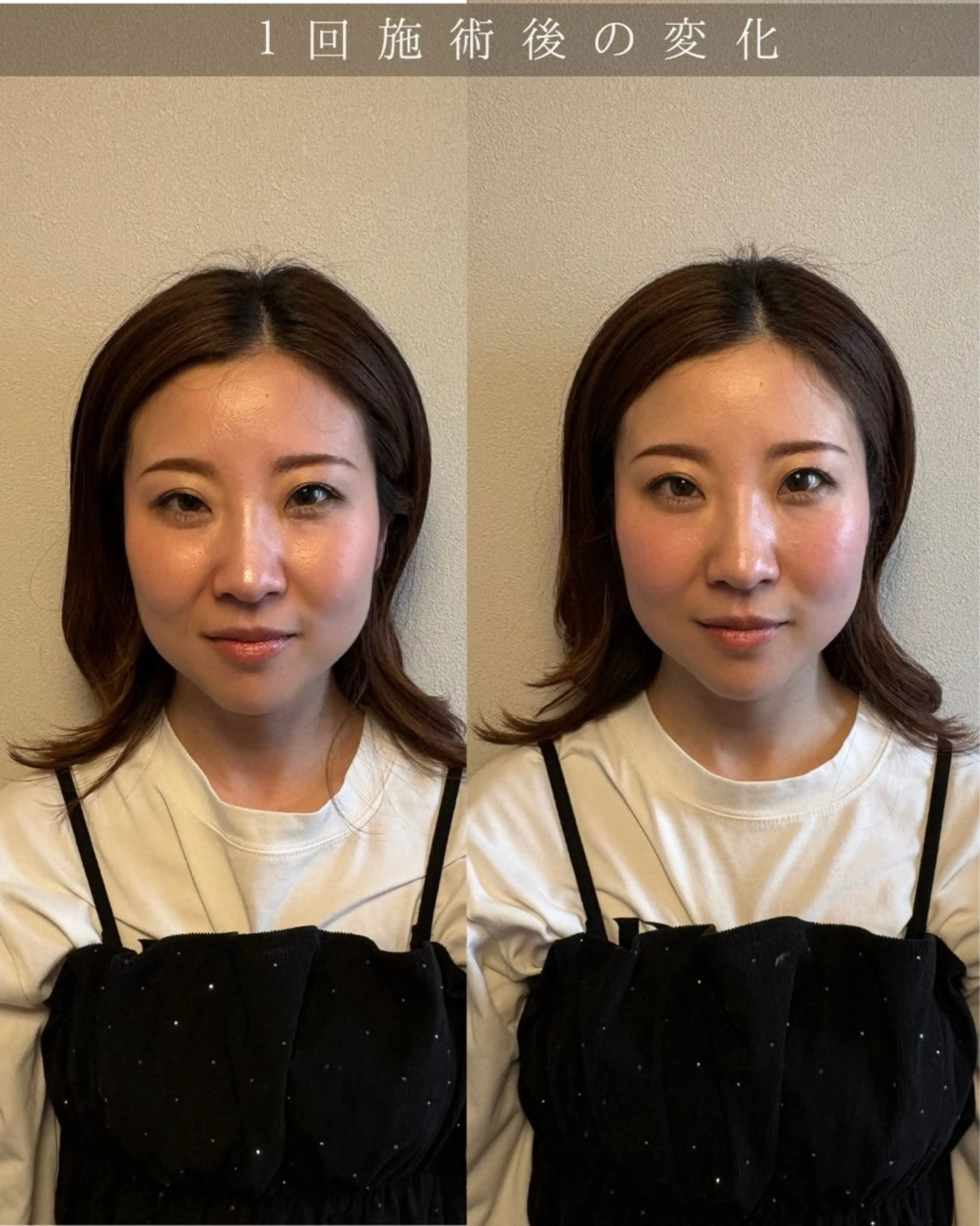 Noelie所属・美肌&小顔矯正 Noelieのエステ・リラクイメージ