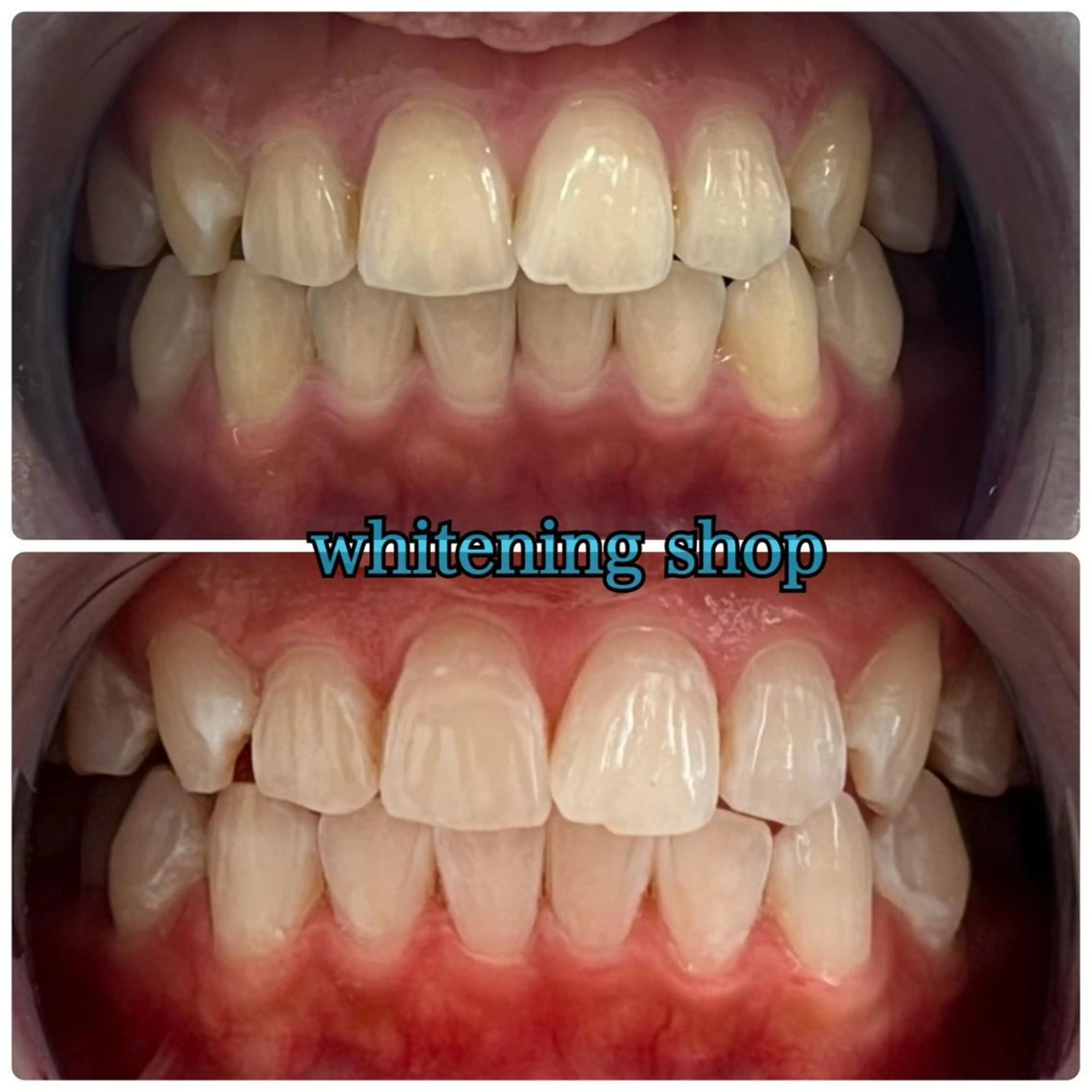 エステ ホワイトニング ショップ千葉店のその他イメージ