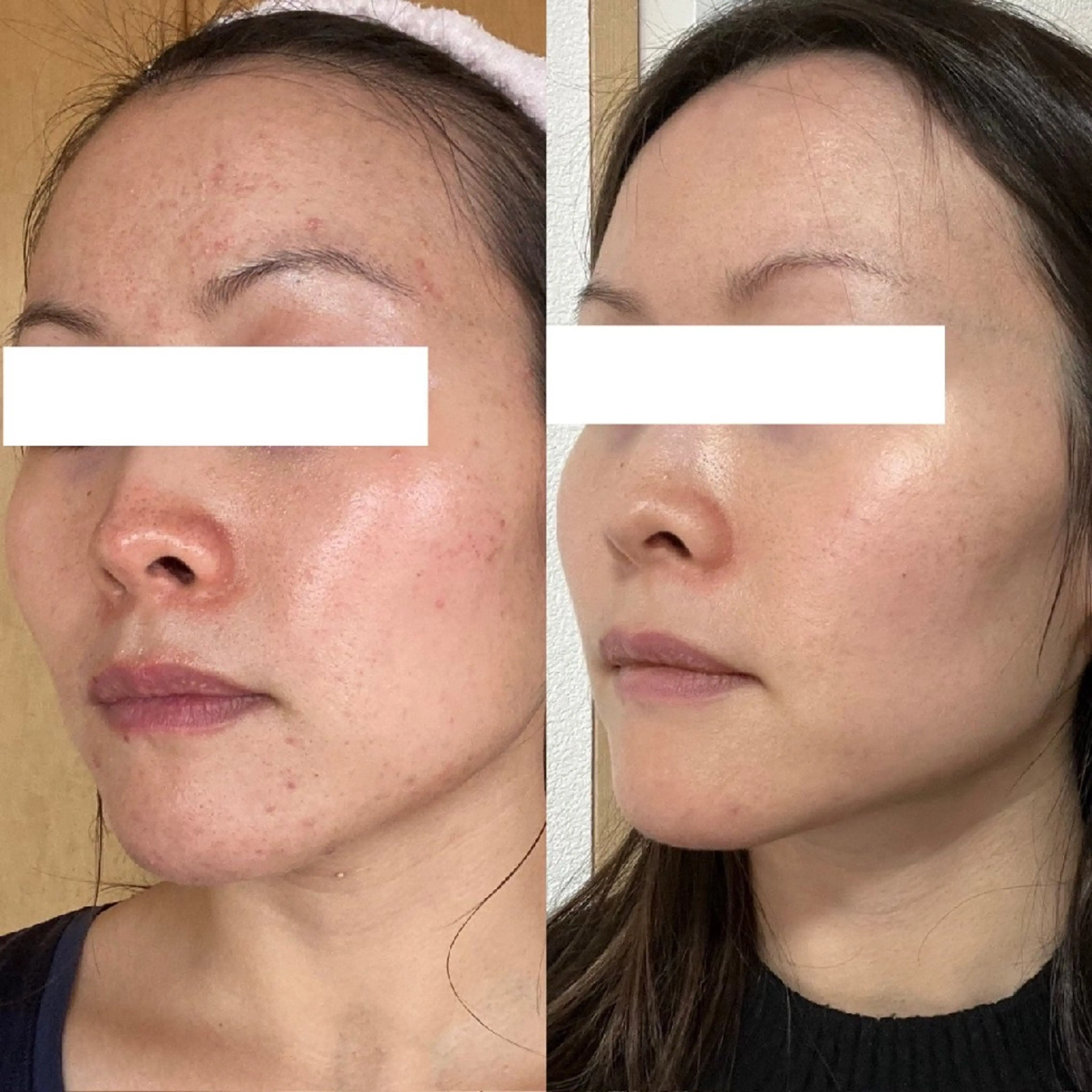 エステ 小顔エステsakura🌸belle(サクラベル)所属・小顔エステ サクラ🌸ベルのエステ・リラクイメージ