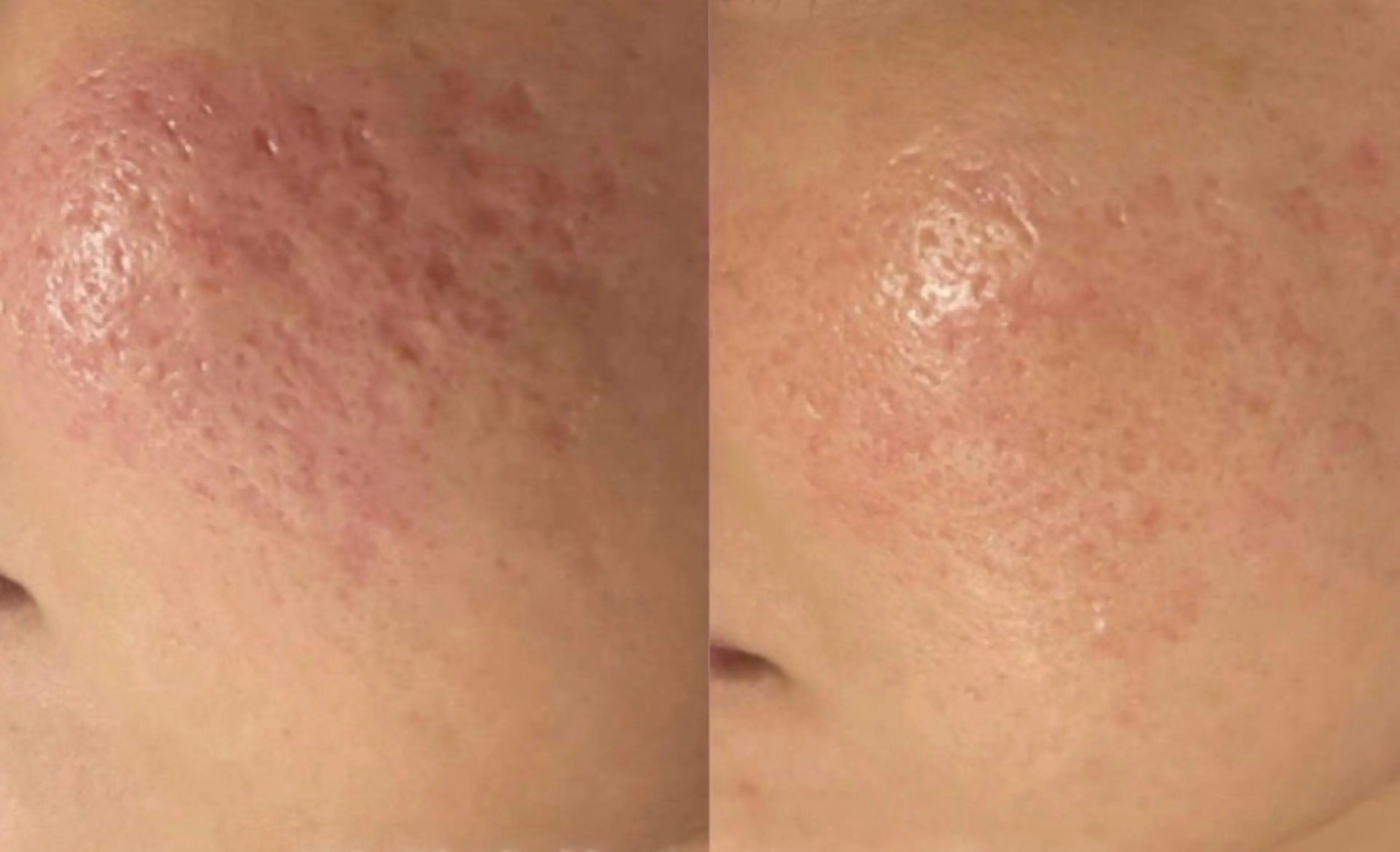 エステ 【BUB立川】 ななのエステ・リラクイメージ