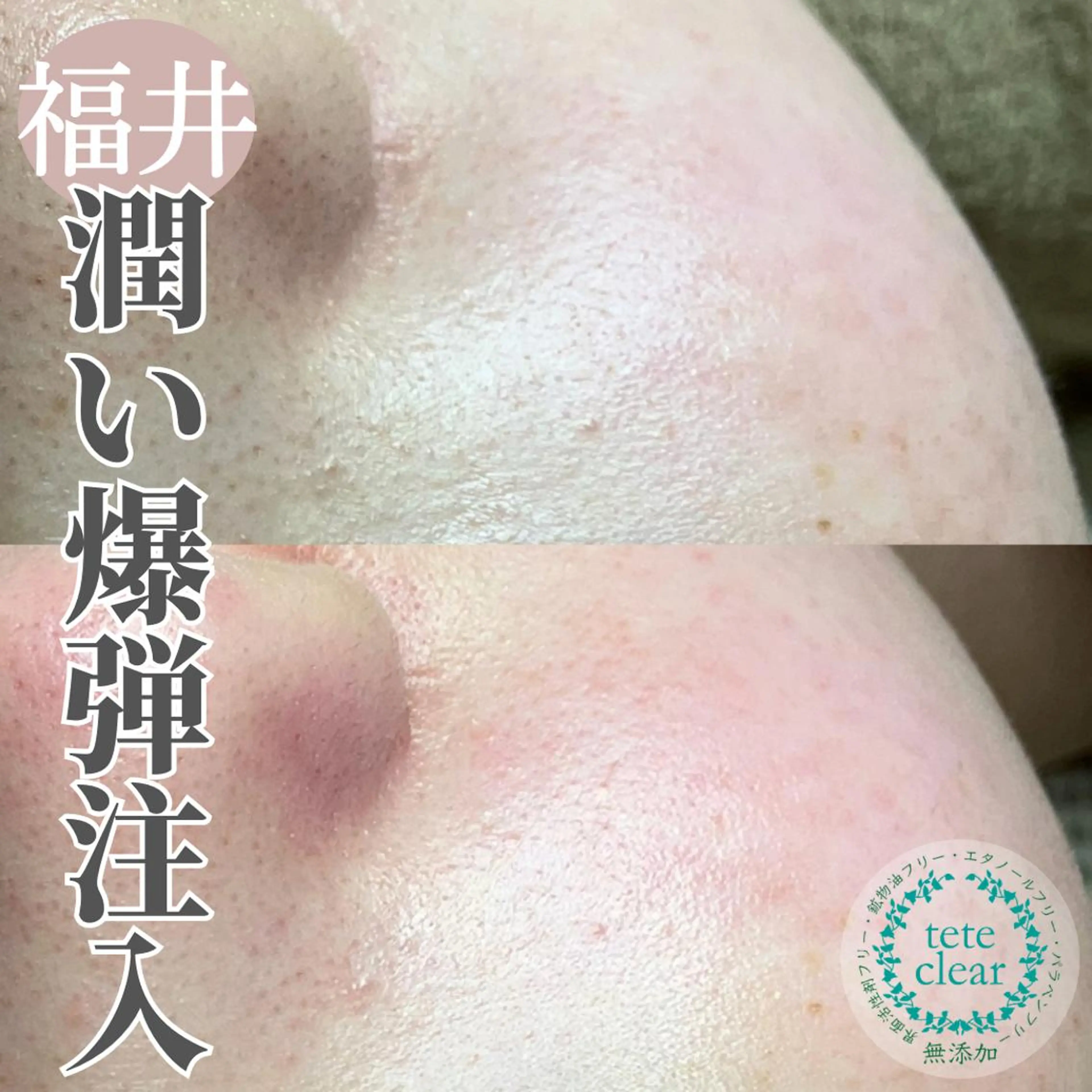 毛穴肌質ケアサロン Yourmeユアミーのエステ・リラクイメージ