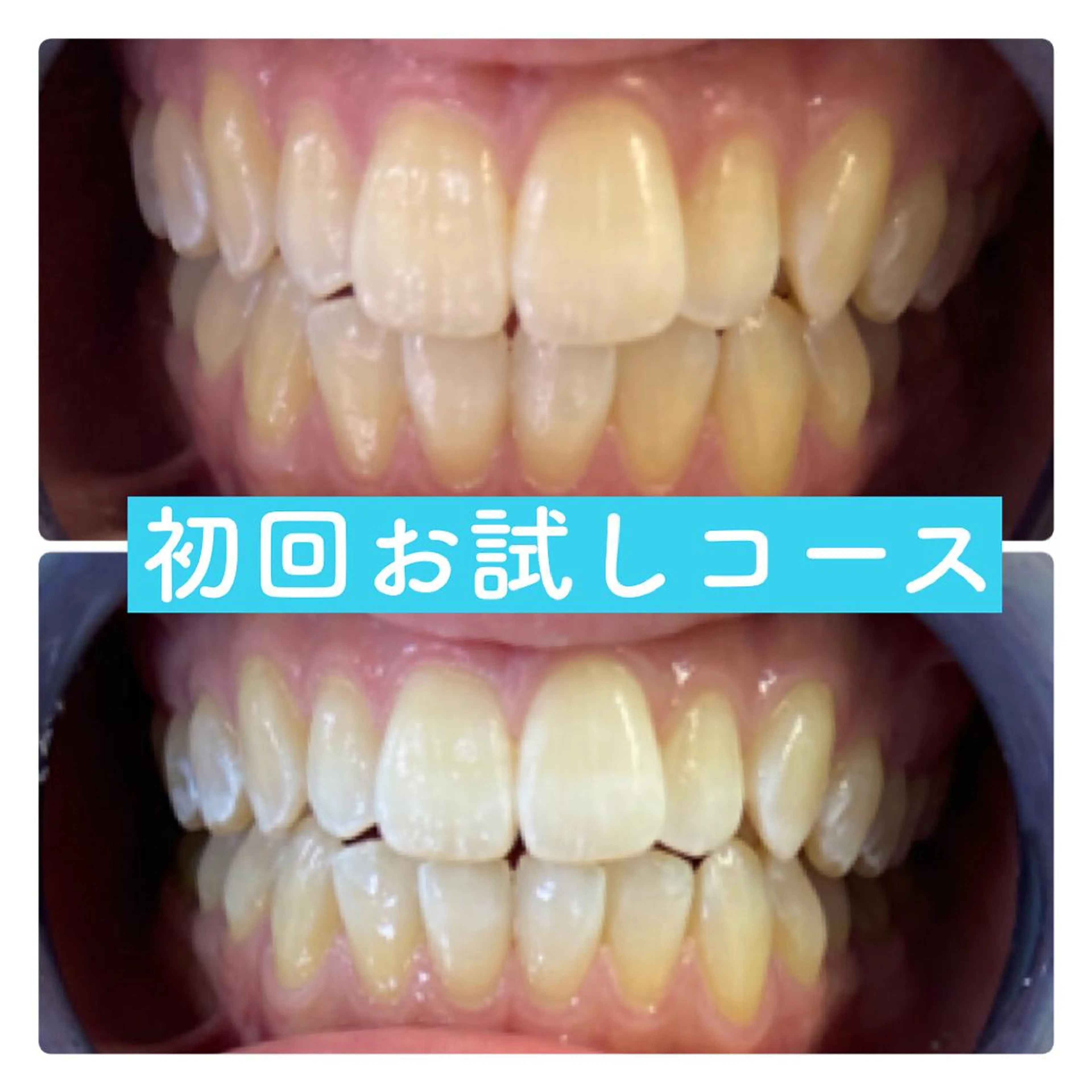 PLATINUM Beauty 横浜店所属・ホワイトニングルーム 横浜店のその他イメージ