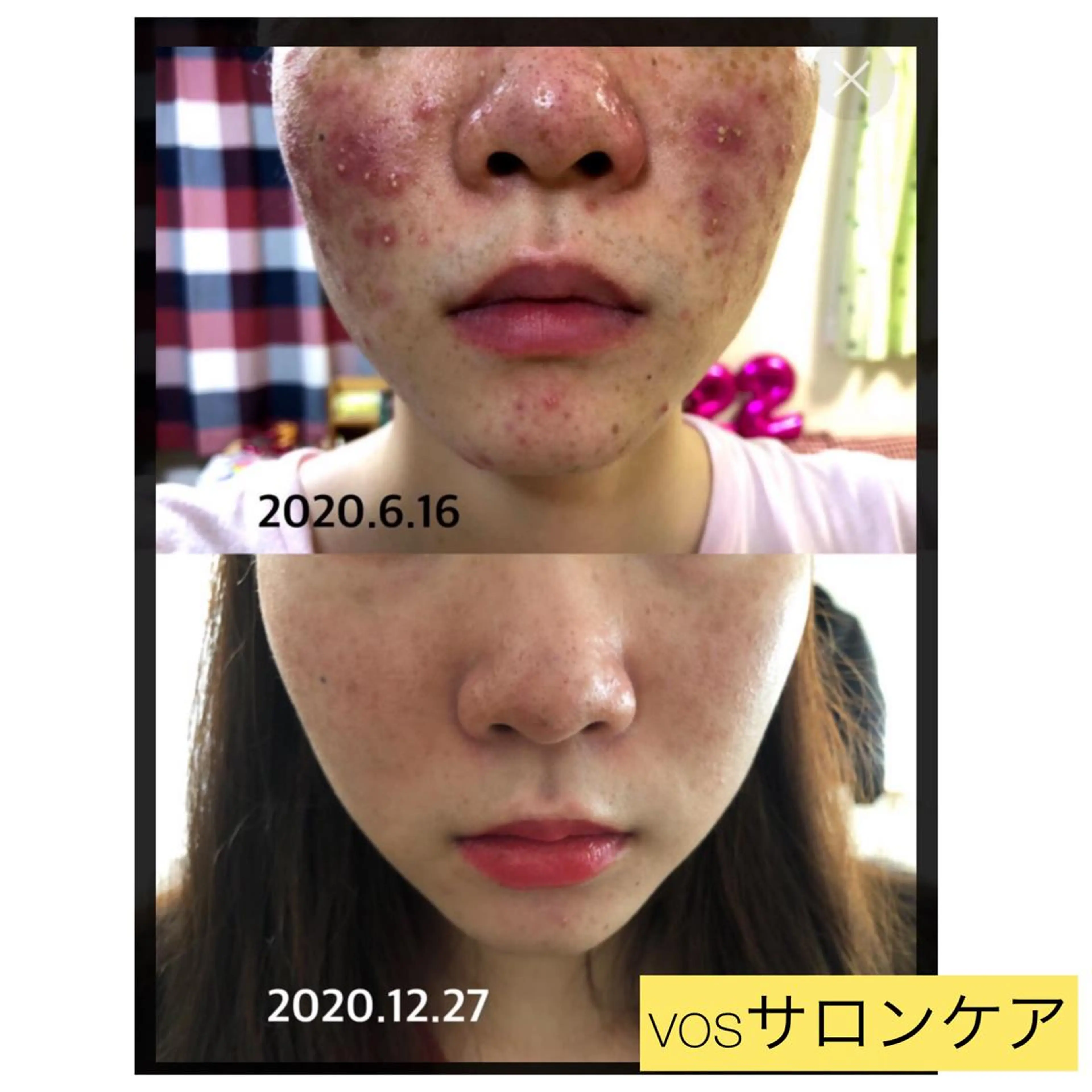 laluna saki...のその他イメージ