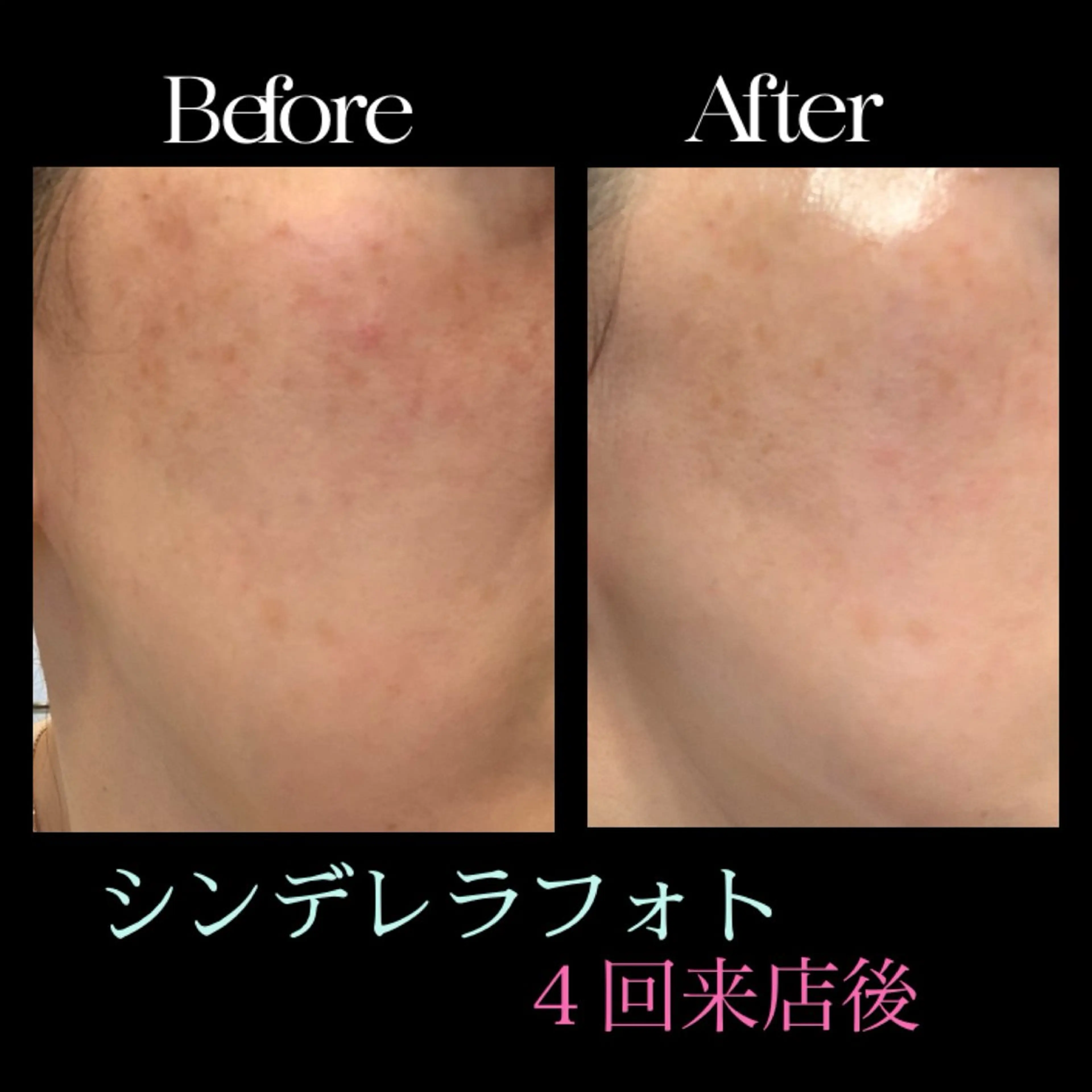 BIST所属・BIST ビストのエステ・リラクイメージ