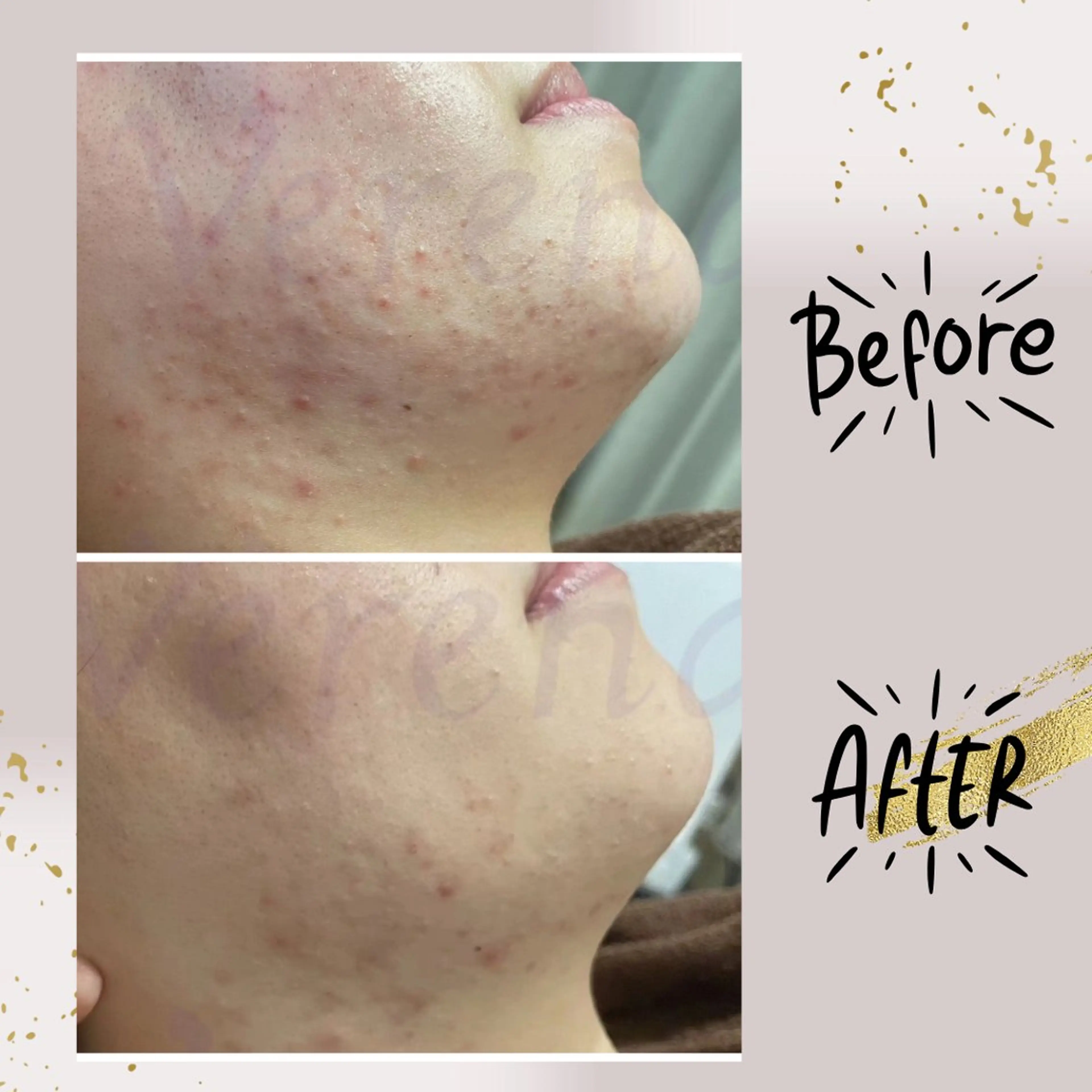 ピーリング専門店 Belluteのエステ・リラクイメージ