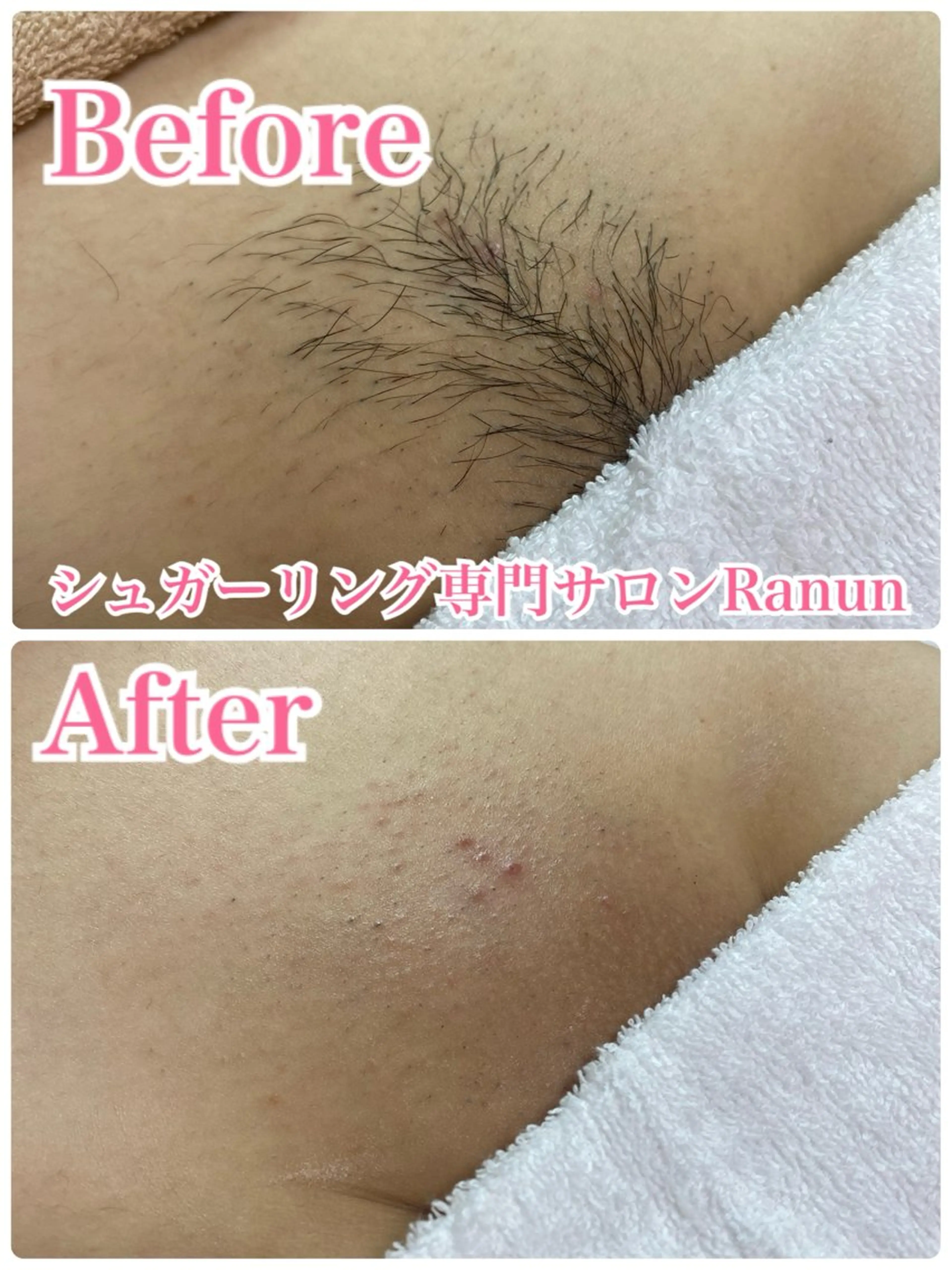 マツエク・マツパ 脱毛 シュガーリング脱毛 専門店Ranunのエステ・リラクイメージ