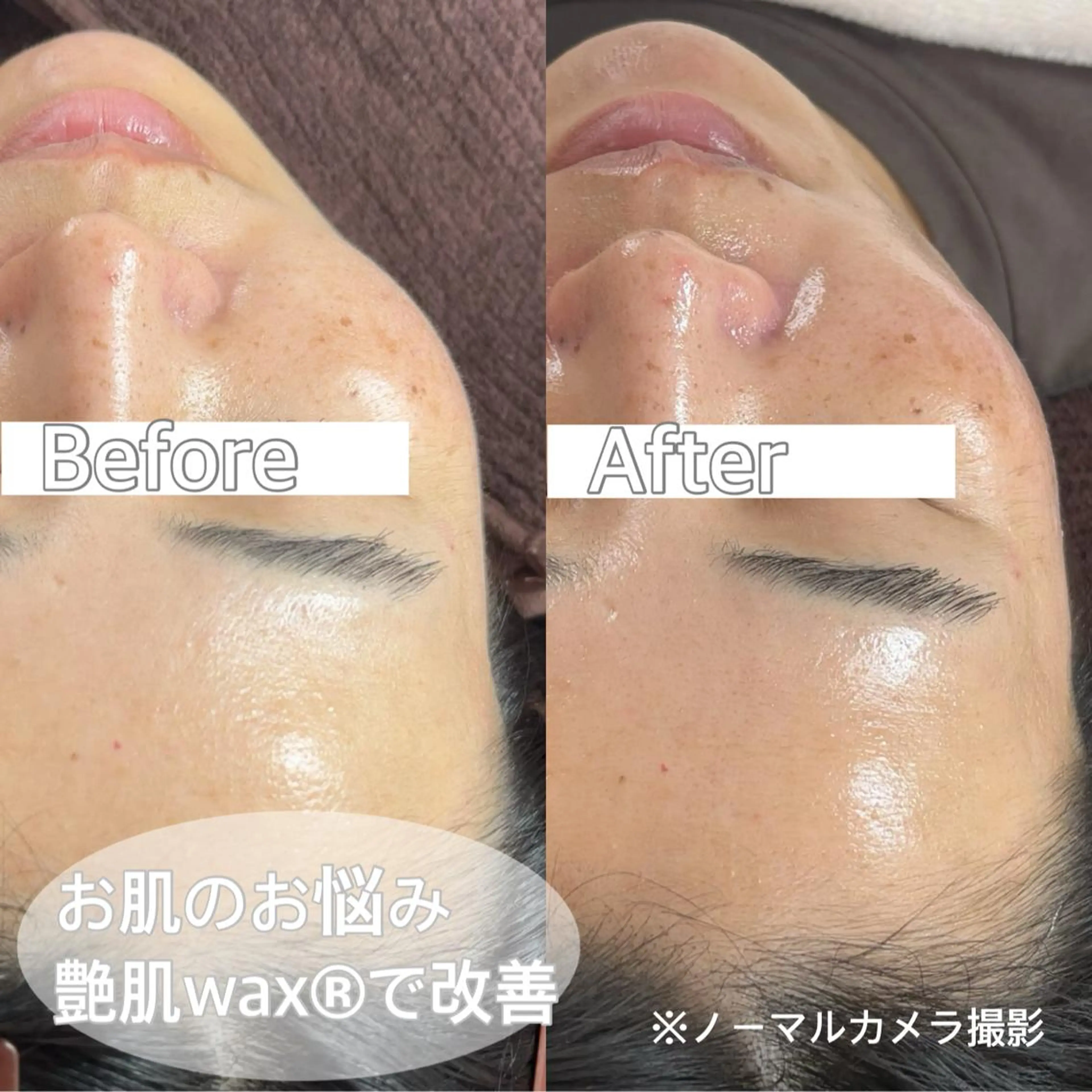 脱毛 吉野 京子のマツエク・マツパデザイン