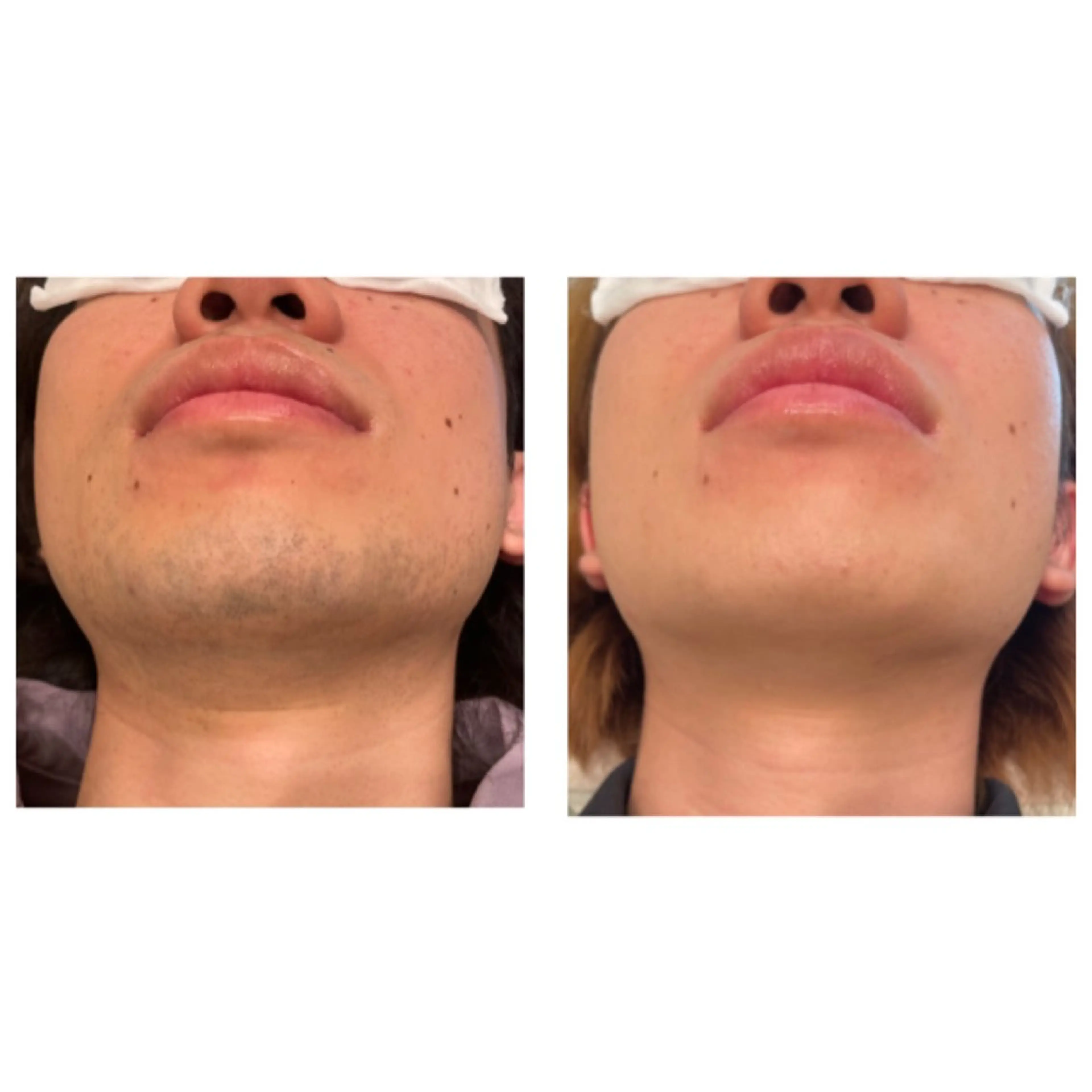 TotalBeautySalon UNCHEL所属・Ito ayakaのマツエク・マツパデザイン