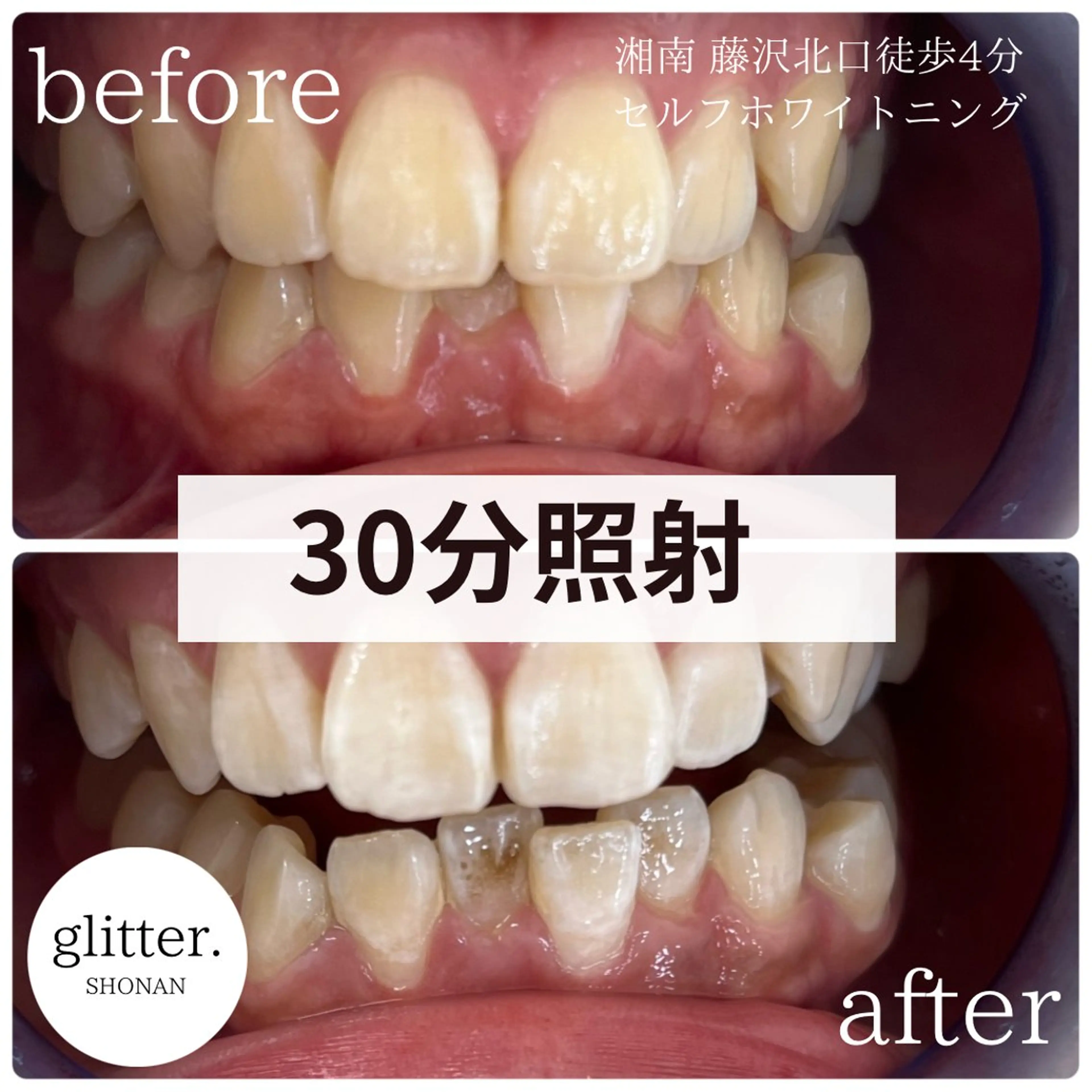 glitter.SHONAN所属・佐久間 茉弥のエステ・リラクイメージ