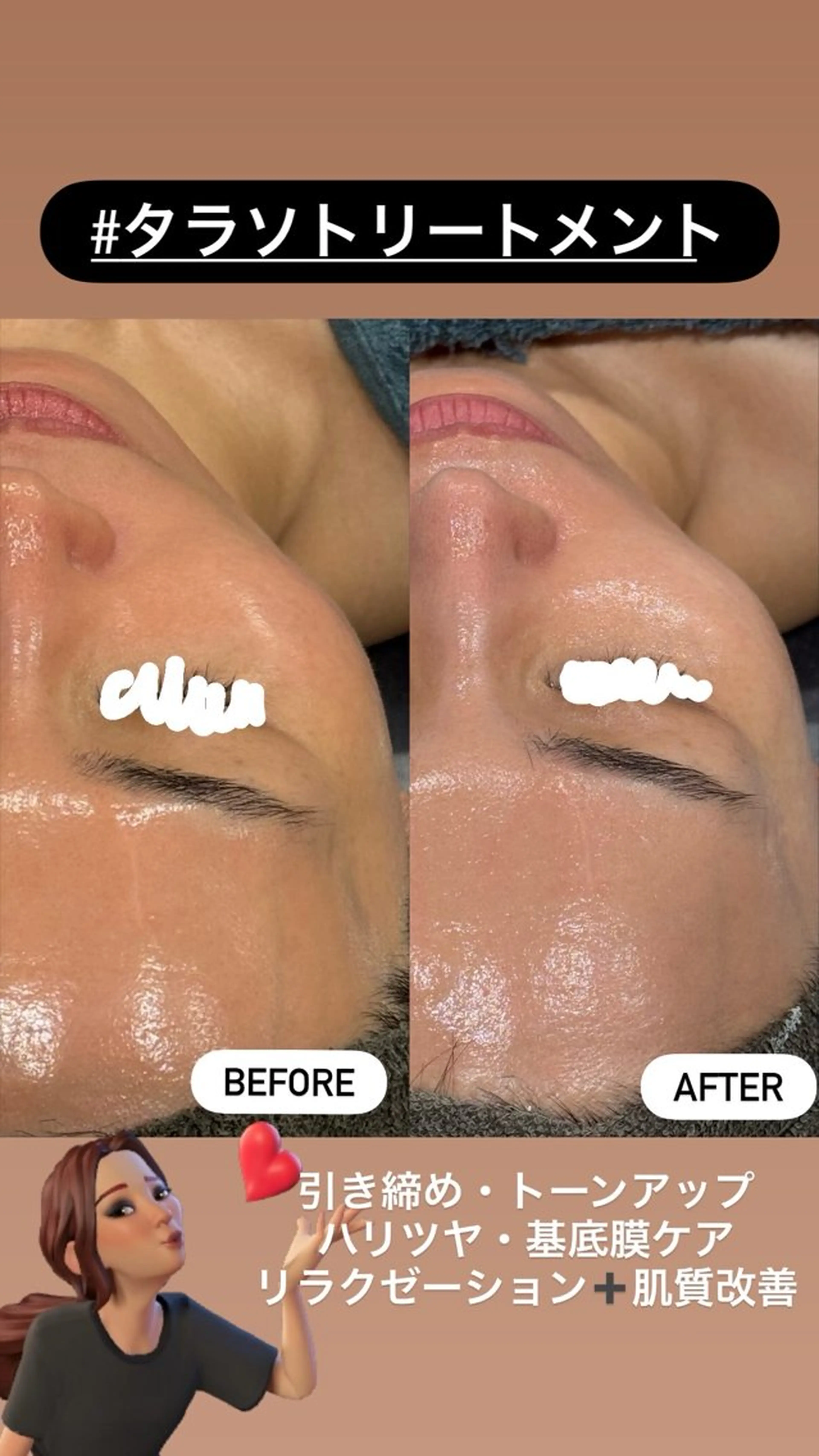 エステ LiZA エステティックサロンのエステ・リラクイメージ