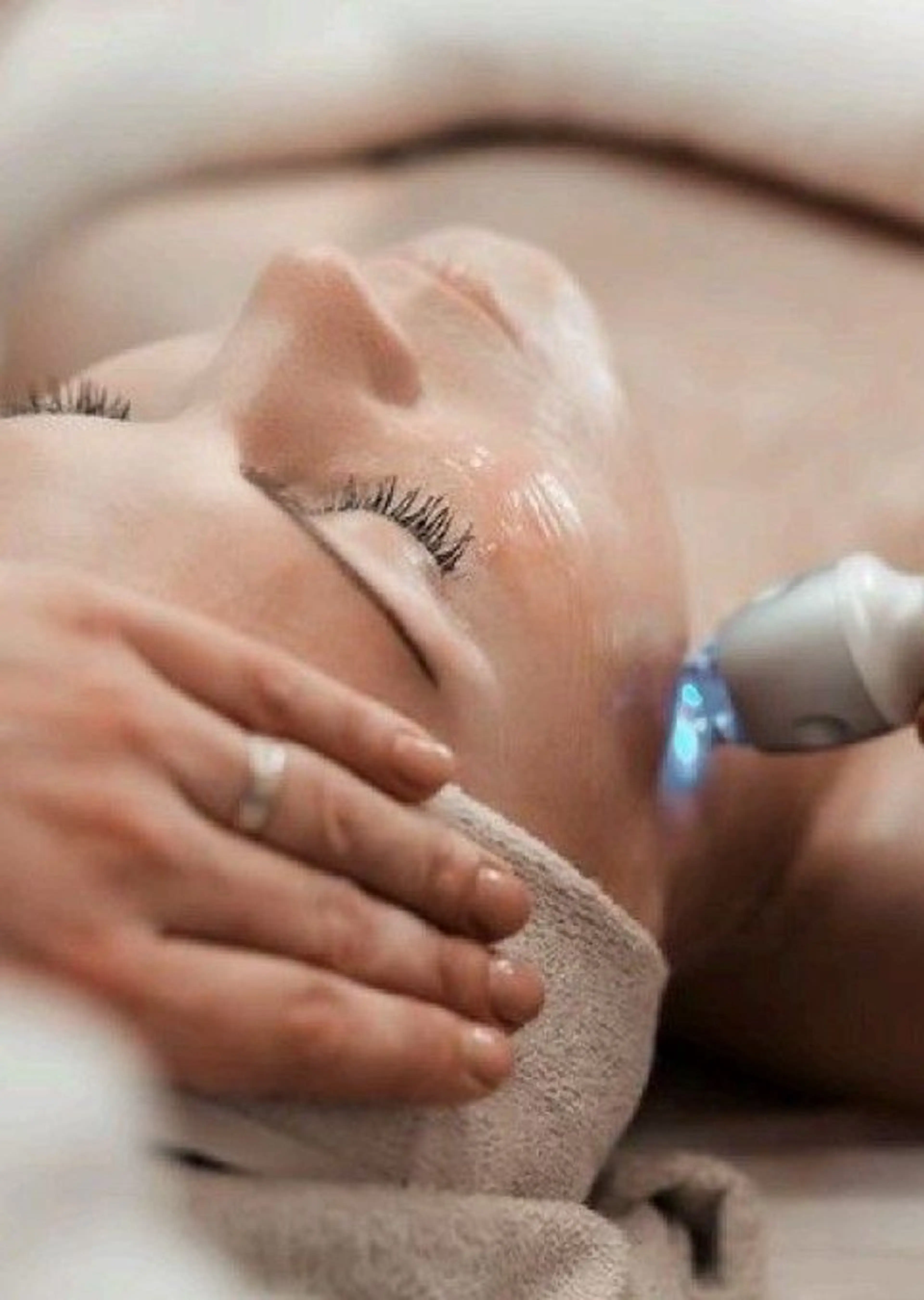 ラジオ波フェイシャル🌷顔のむくみ、血流UPで小顔🩷お肌のハリ・弾力にアプローチの写真