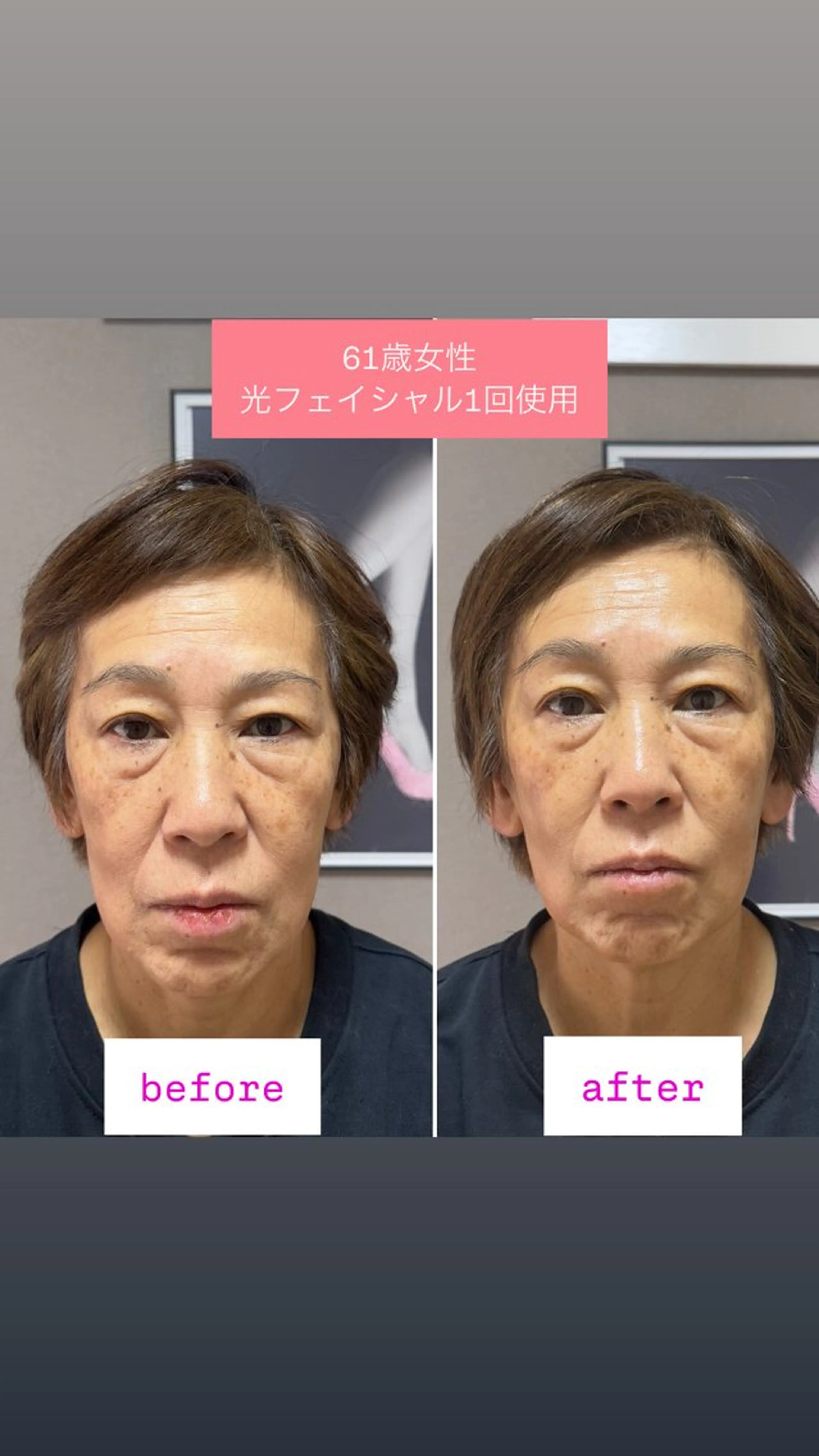 エステ Uruka関本 ふみ佳のエステ・リラクイメージ