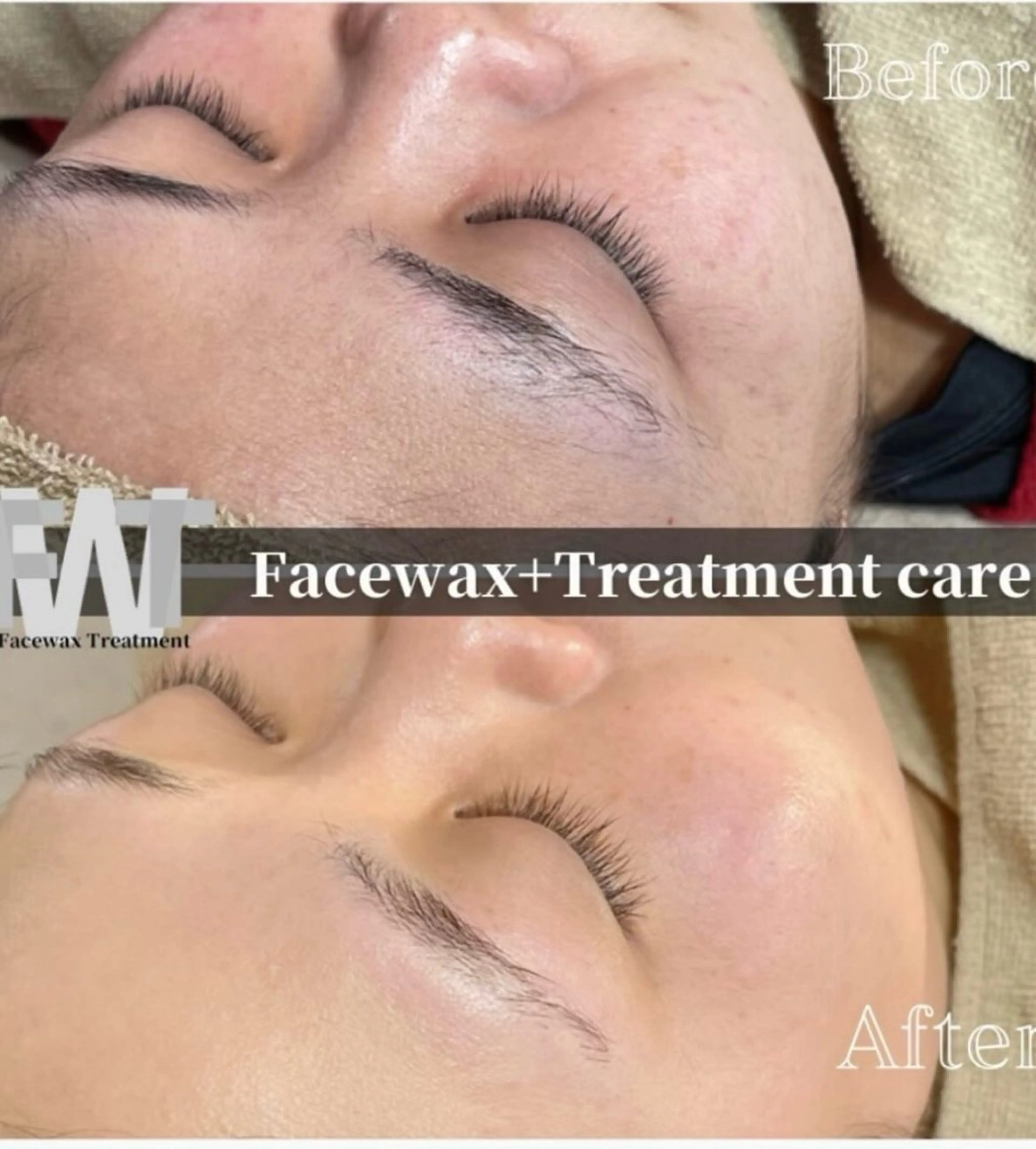 Remove所属・Remove .のエステ・リラクイメージ