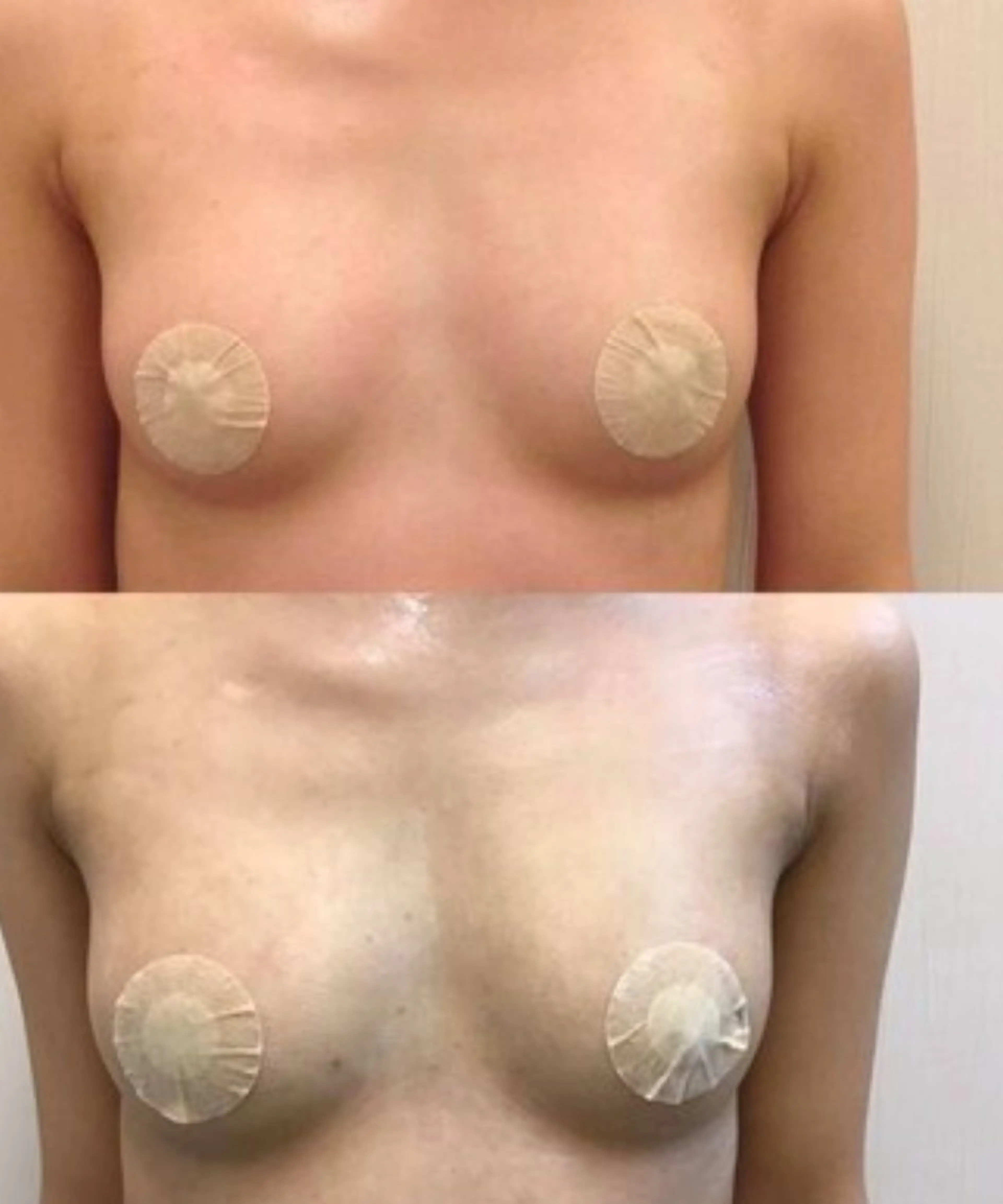 【人気No.1★全身ケア】憧れのふるふわ谷間へ♪極上バストアップエステ（100分）【お試し体験価格】の写真