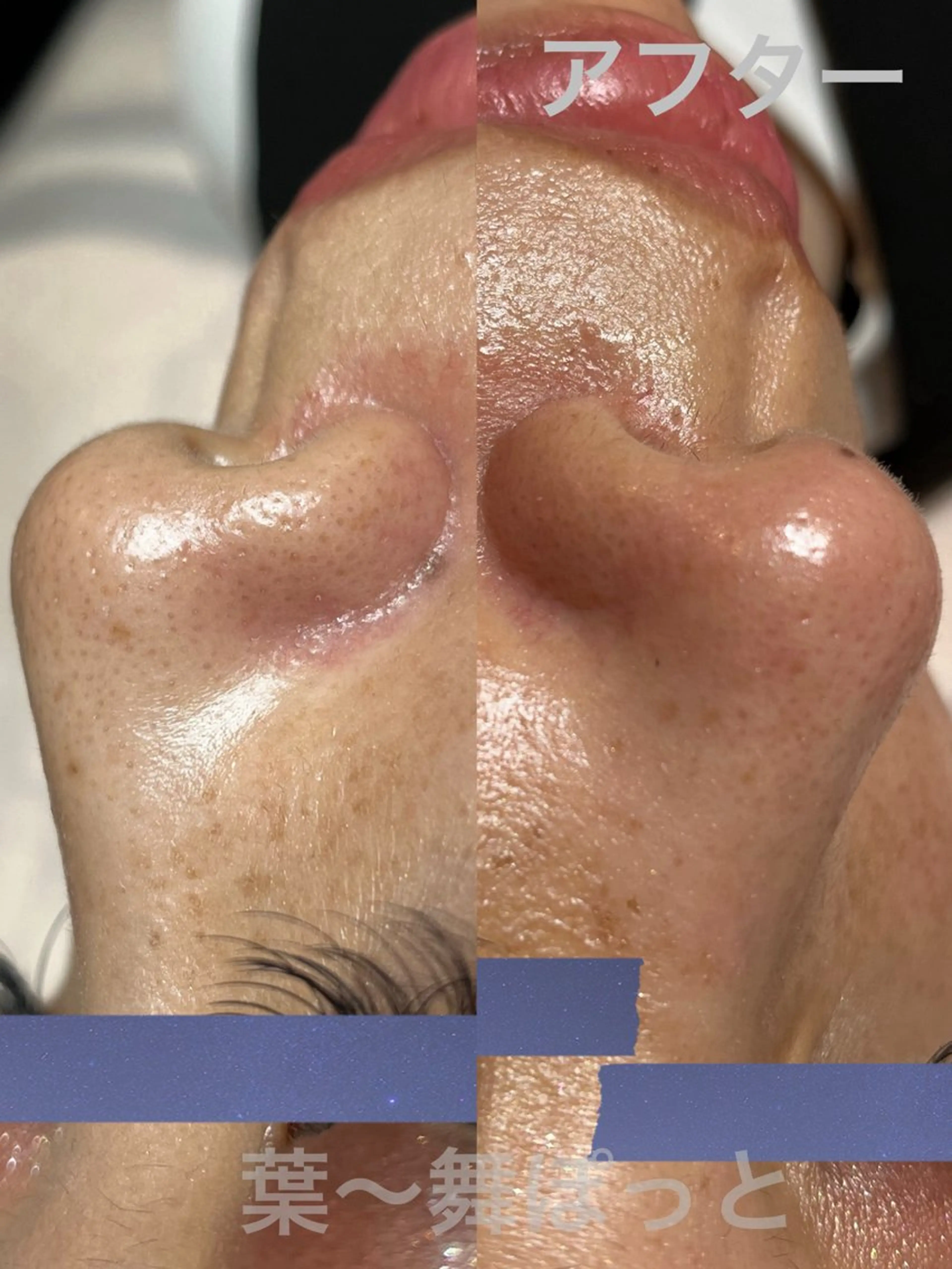 うえつま ふみえのエステ・リラクイメージ