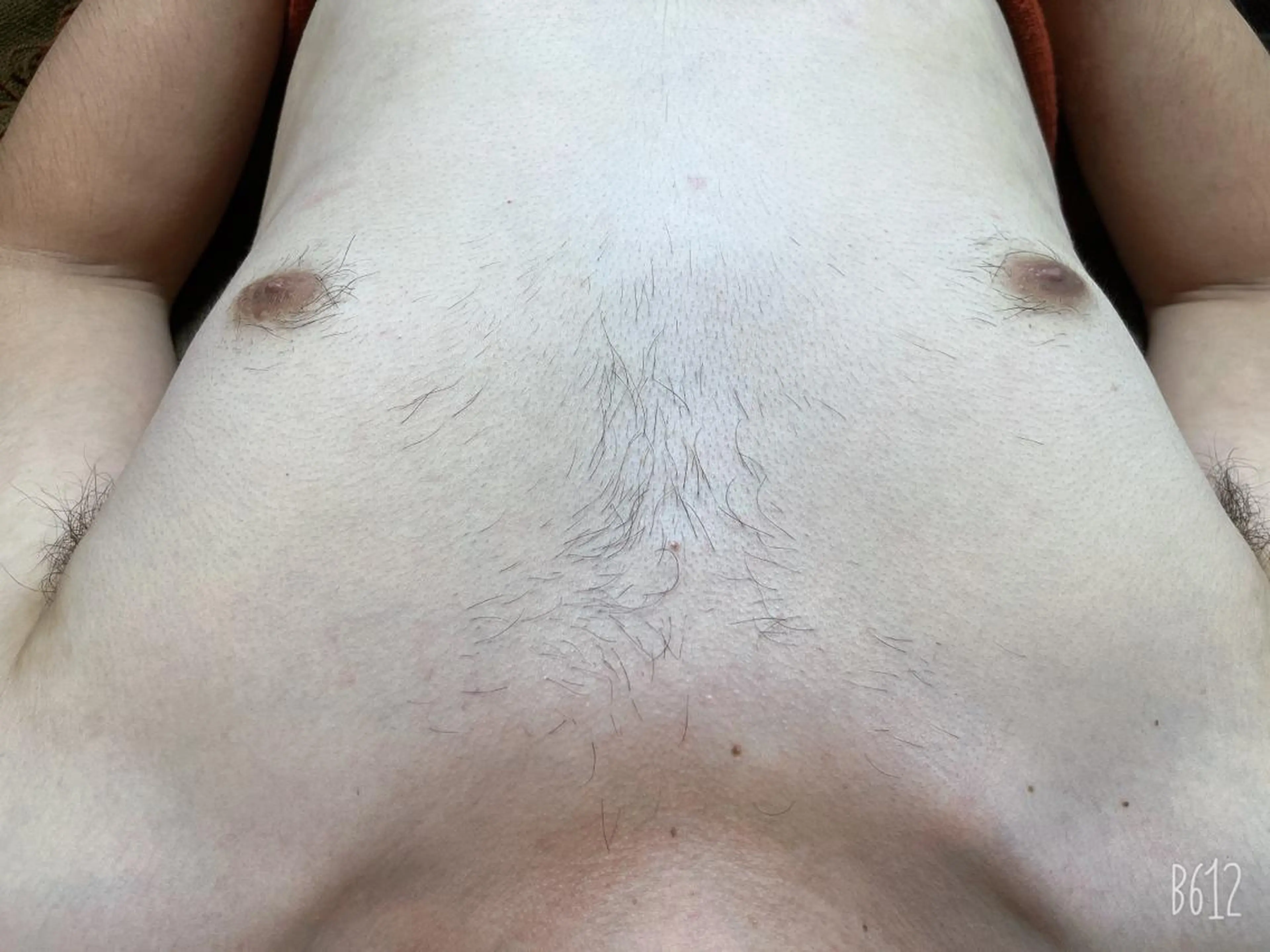 全身脱毛※メンズ料金有の写真