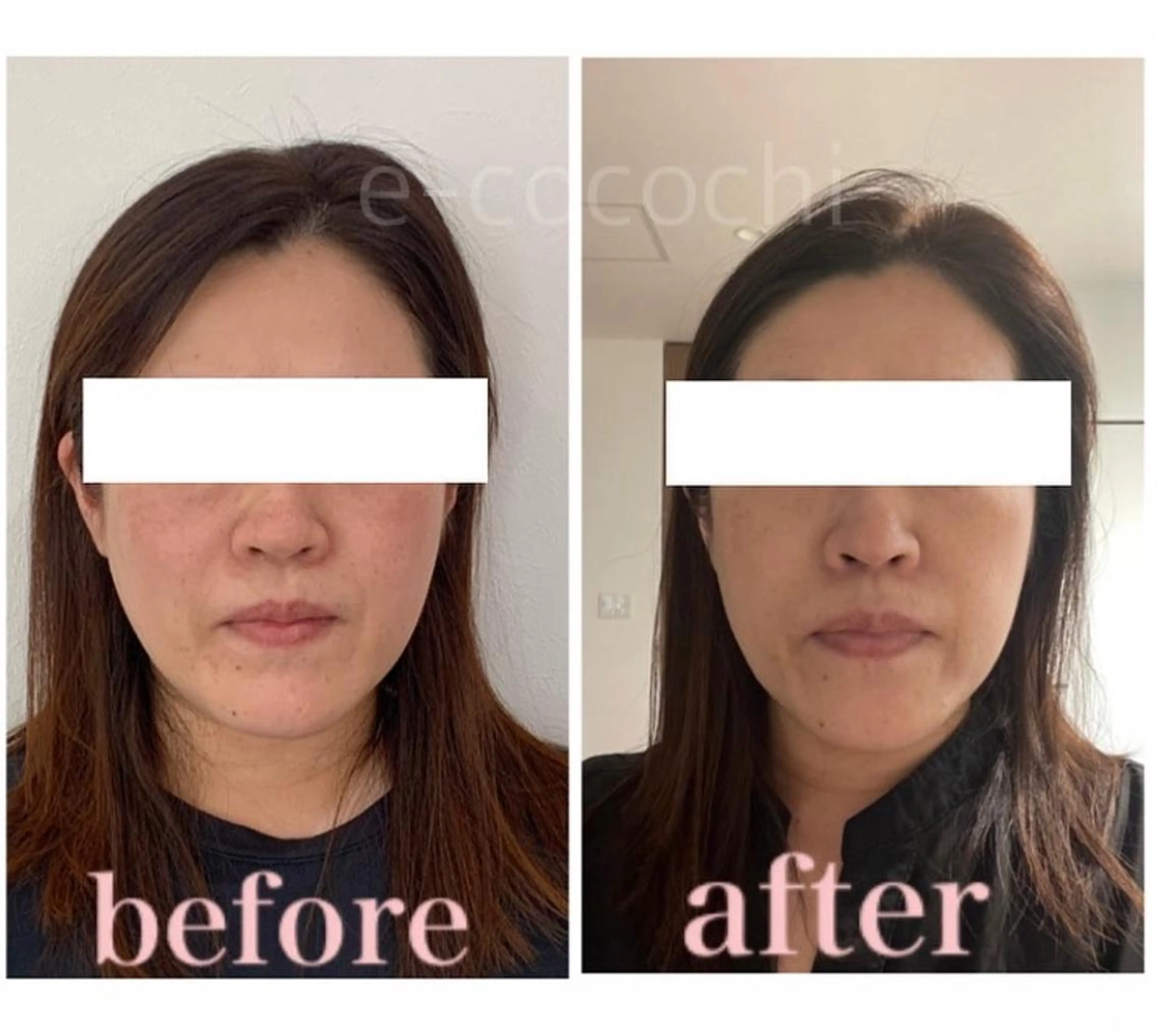 エステ リラク 小顔と ヘッドスパのお店のエステ・リラクイメージ