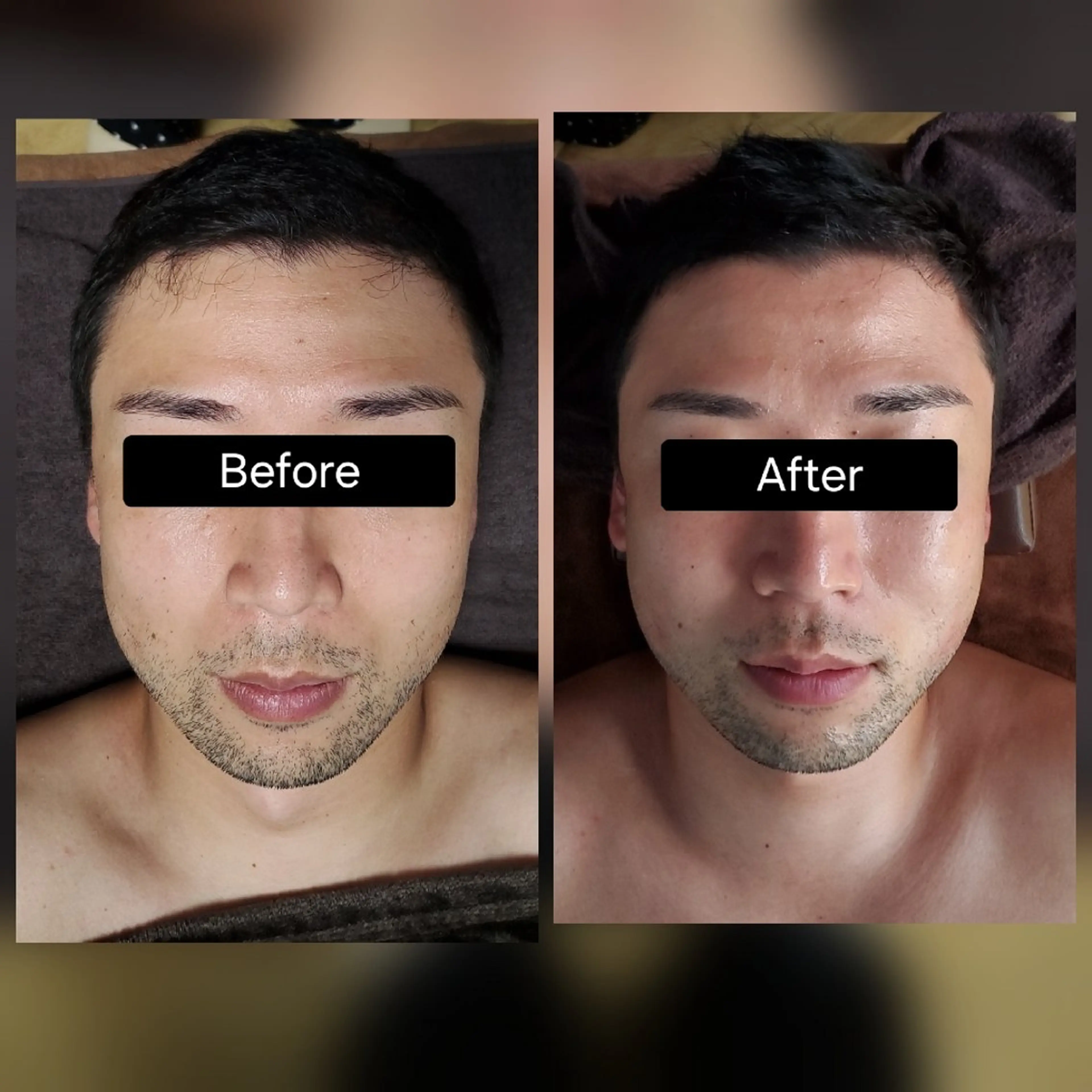 小顔矯正 LNのエステ・リラクイメージ