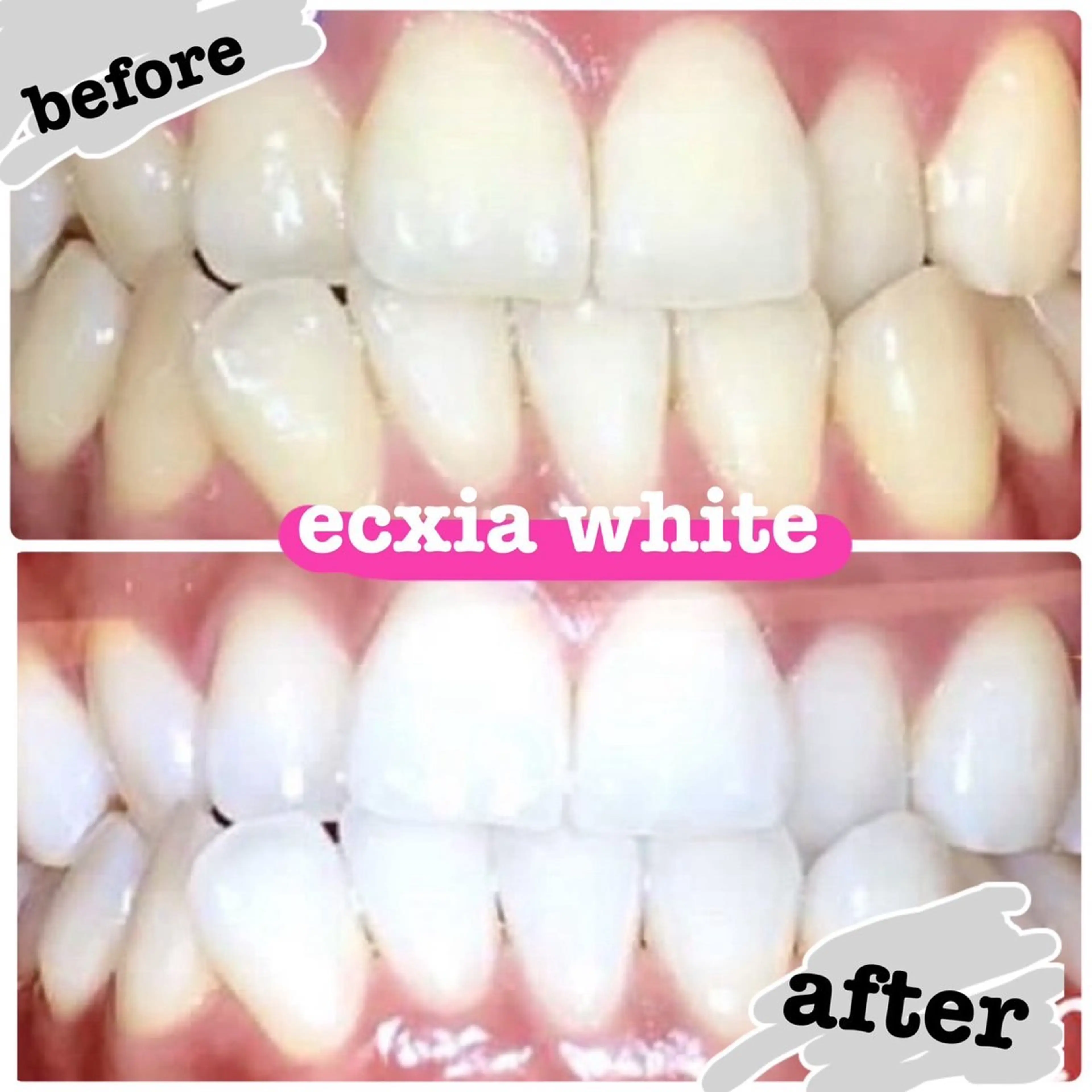 【定額通い放題】★セルフホワイトニング月額1万円の通い放題★の写真