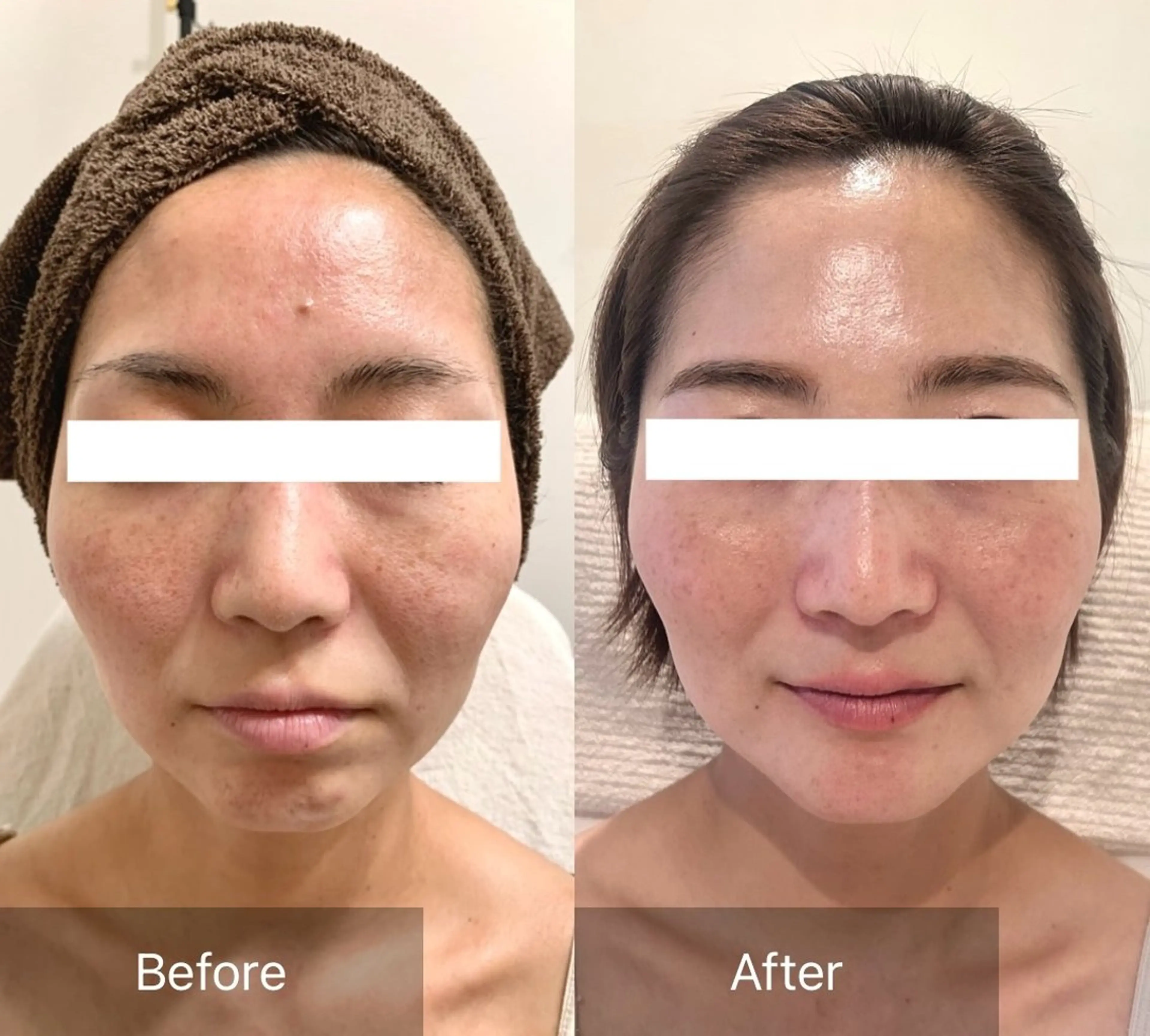 Charis エステ&ネイルのエステ・リラクイメージ