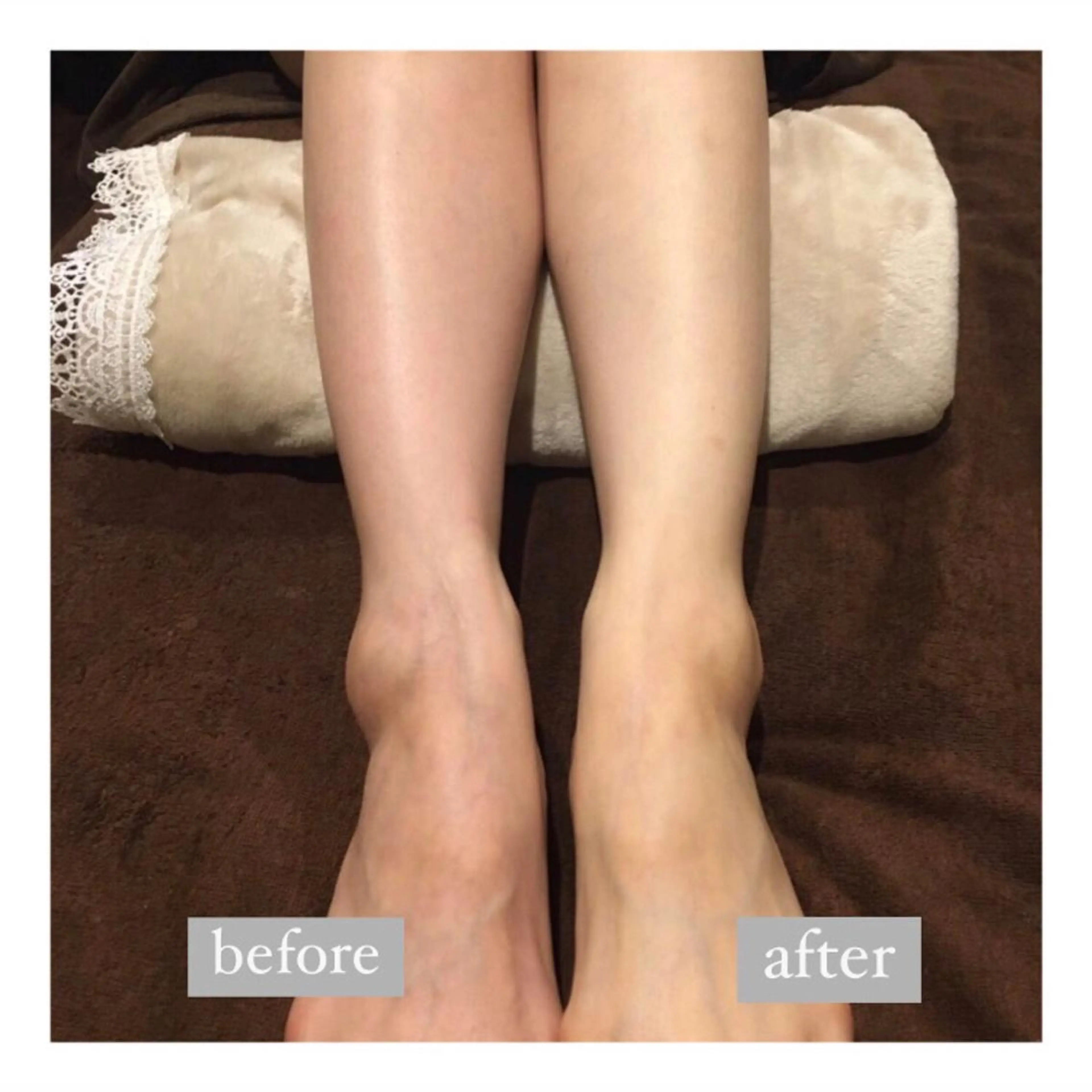 美肌脱毛専門サロン Dione栄店のエステ・リラクイメージ