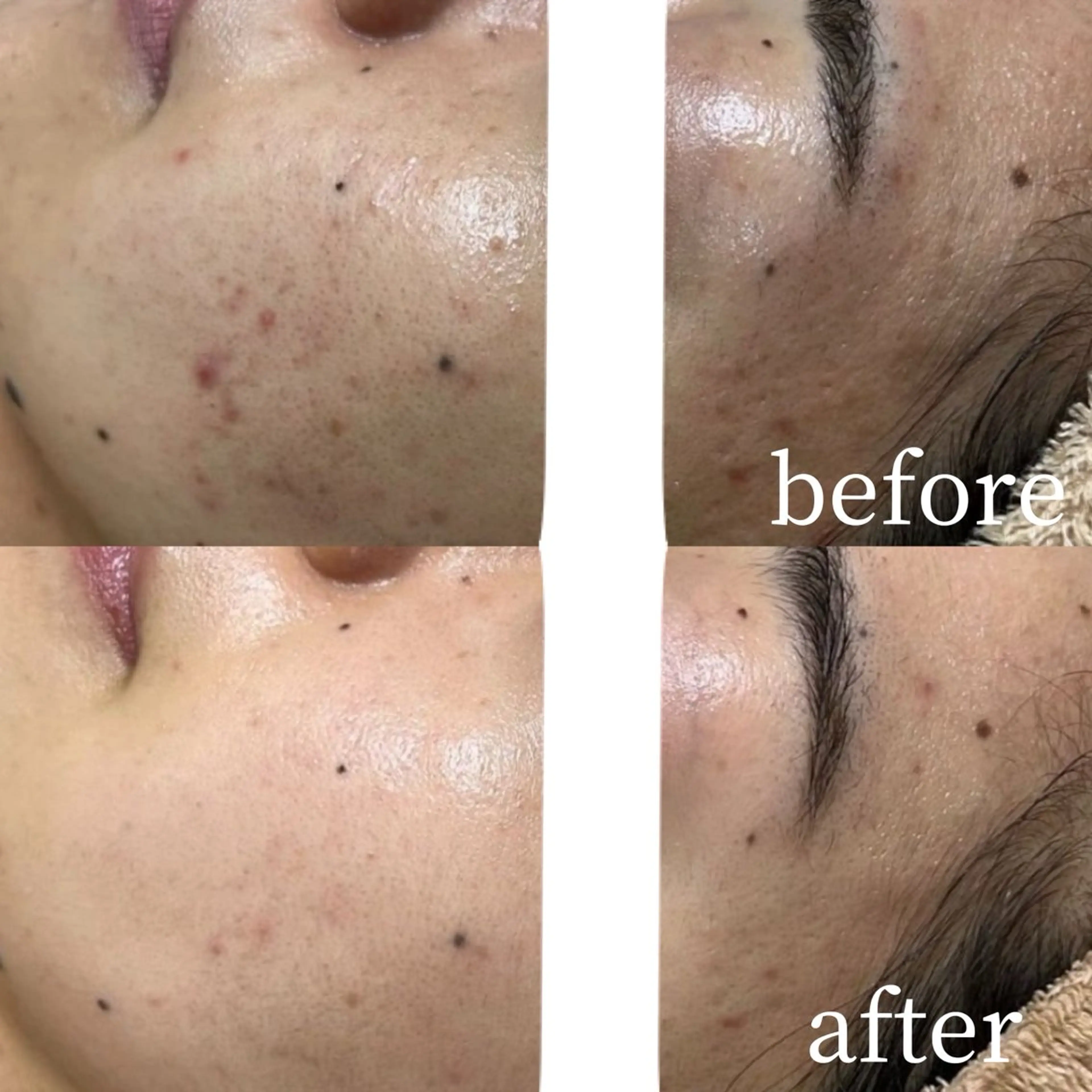 エステ aimer 栄店のエステ・リラクイメージ