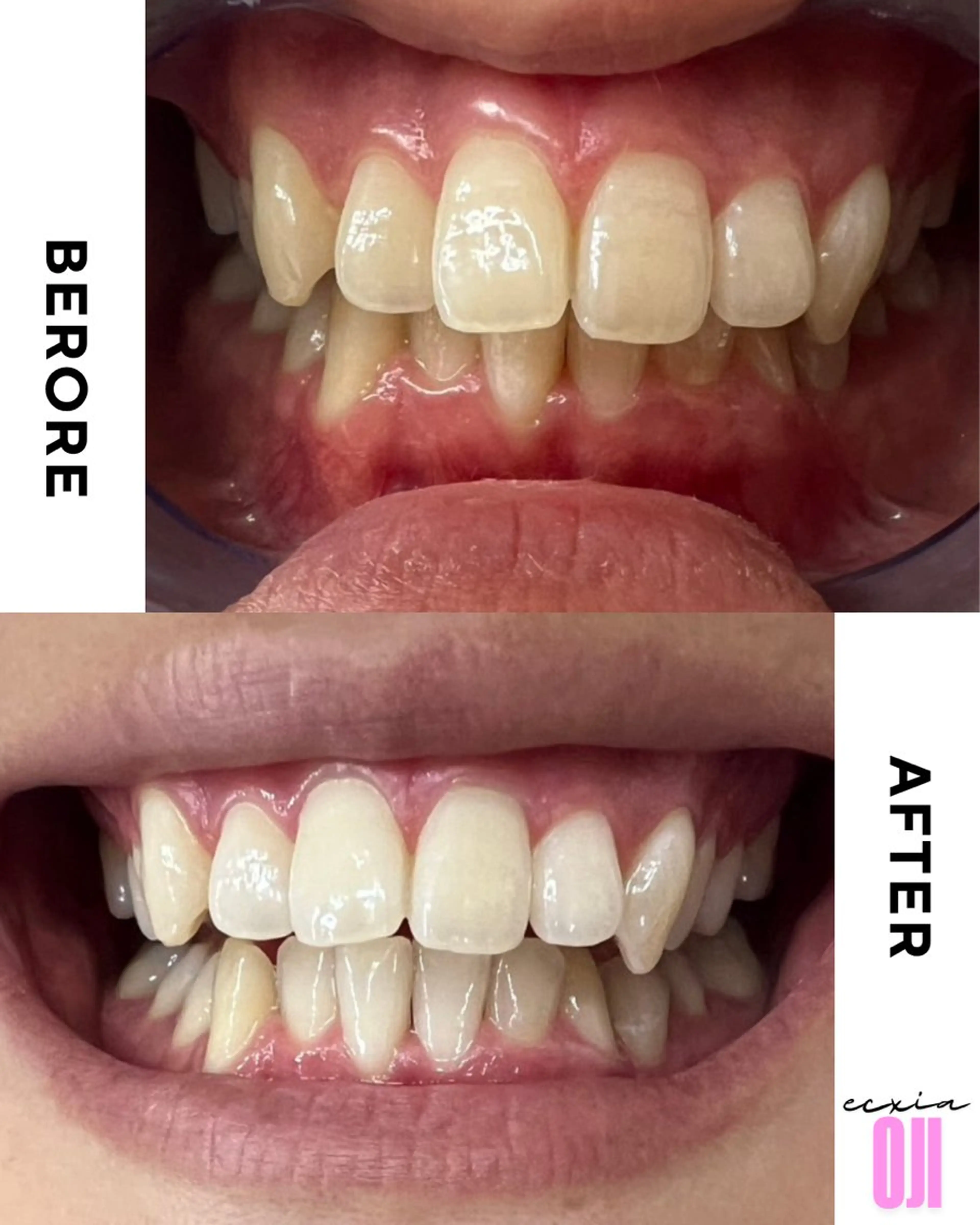 その他 セルフホワイトニングサロン  エクシアホワイト 王寺店所属・エクシア王寺 NISHIKAWAのその他イメージ