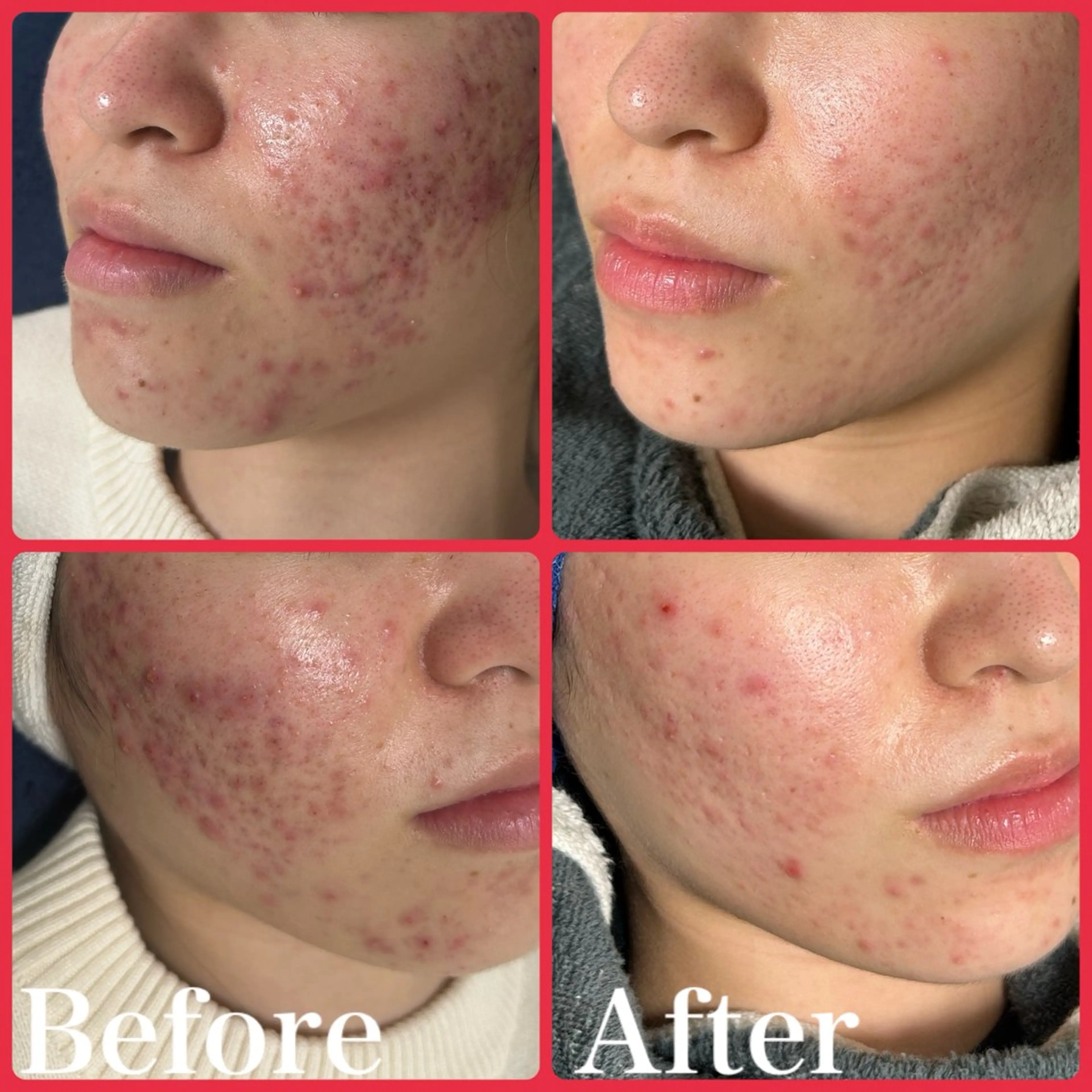 skin make salon -Olu's-所属・毛穴・肌質改善サロン ✨Tomaのその他イメージ