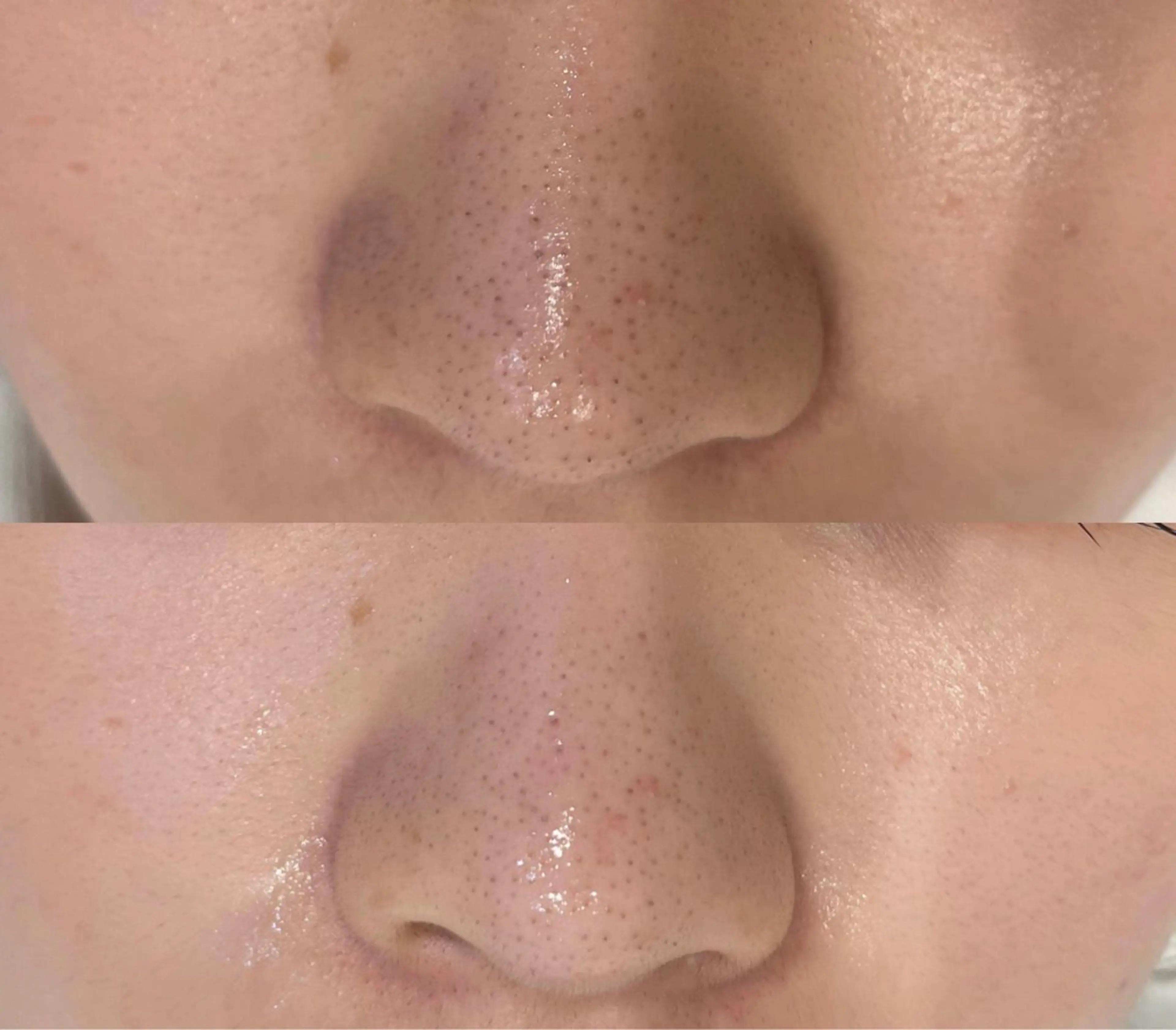 DeI'm   名古屋栄所属・小林 玲菜のエステ・リラクイメージ