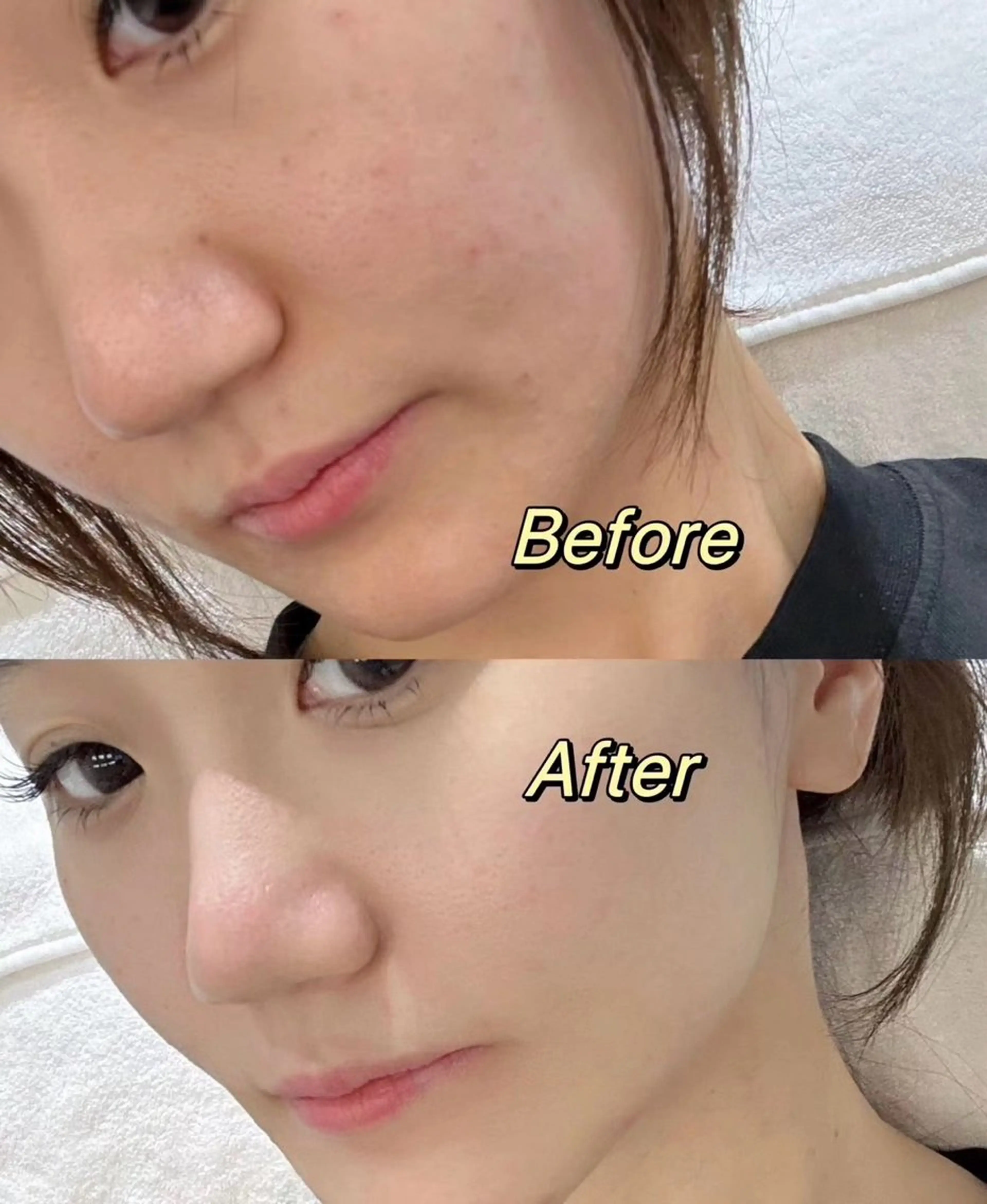 エステ リラク 愛維美水光美肌専門店所属・愛維美水光美肌専門店 メンズレディースokのエステ・リラクイメージ