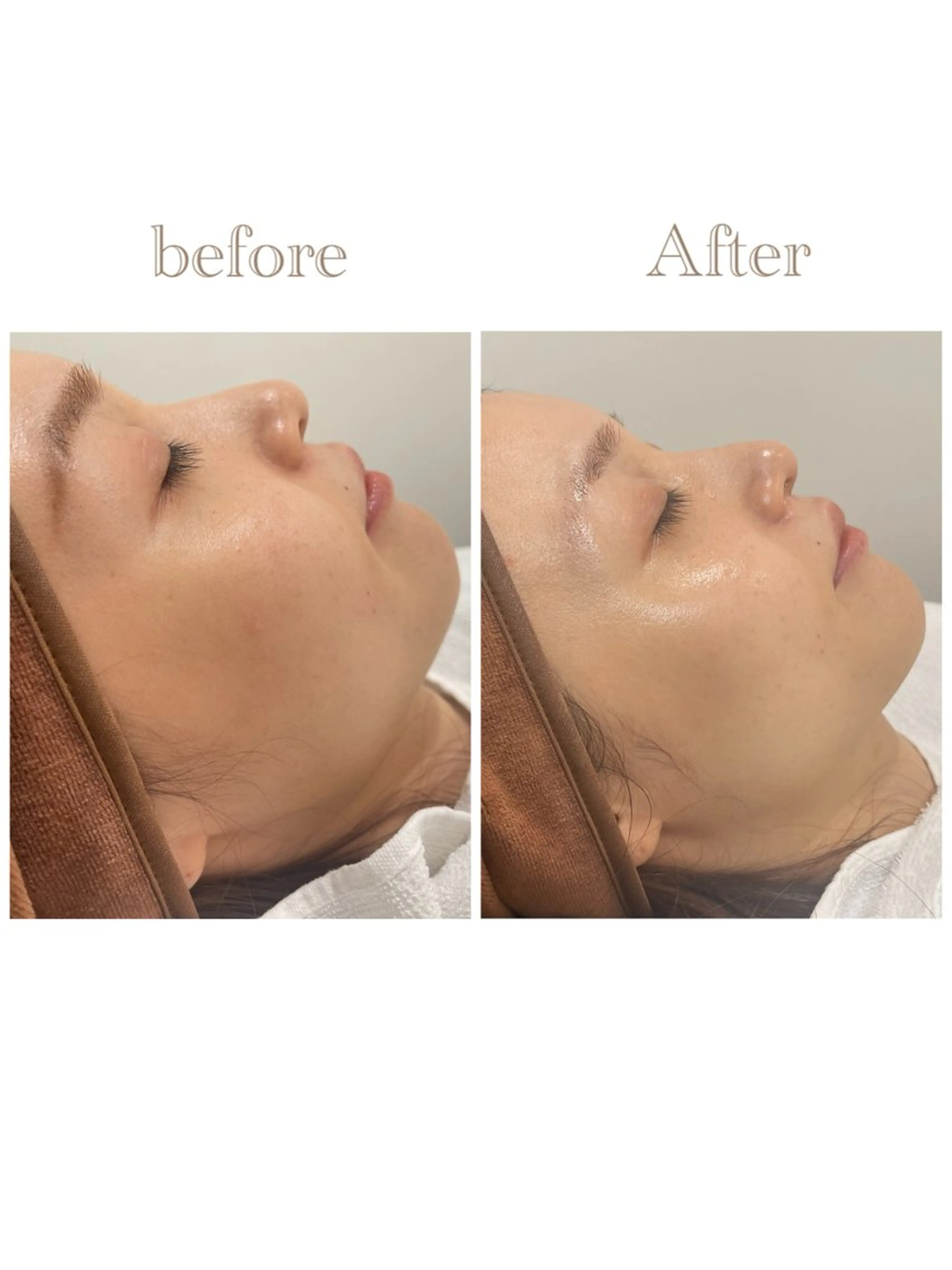 お肌の角質ｹｱ / ﾍﾞﾗｽﾃｷﾞのその他イメージ