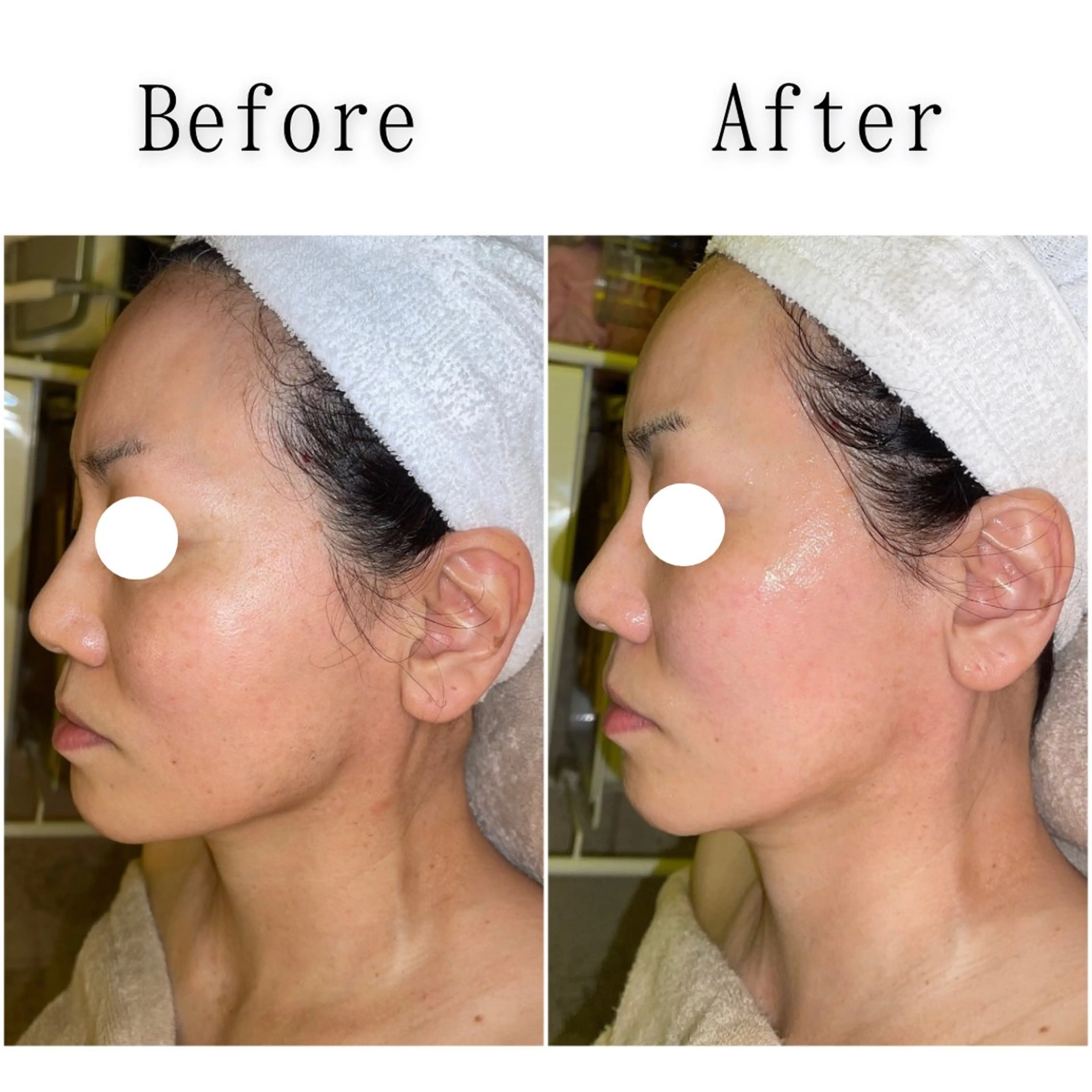 エステ SELF  BEAUTY gracia浦添店所属・gracia 浦添店のその他イメージ