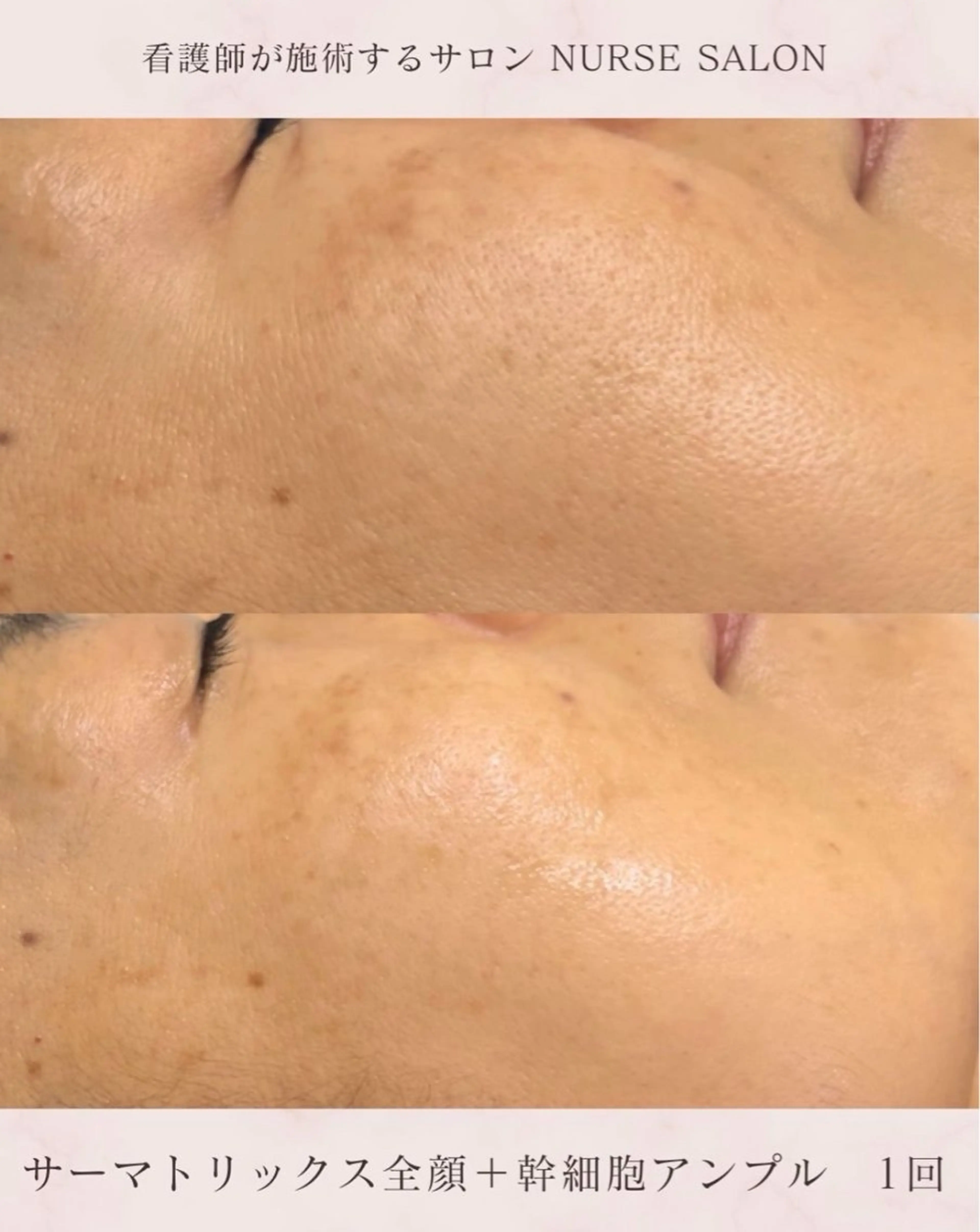 エステ 🌟看護師が施術🪄 ナスサロ/狩野のエステ・リラクイメージ