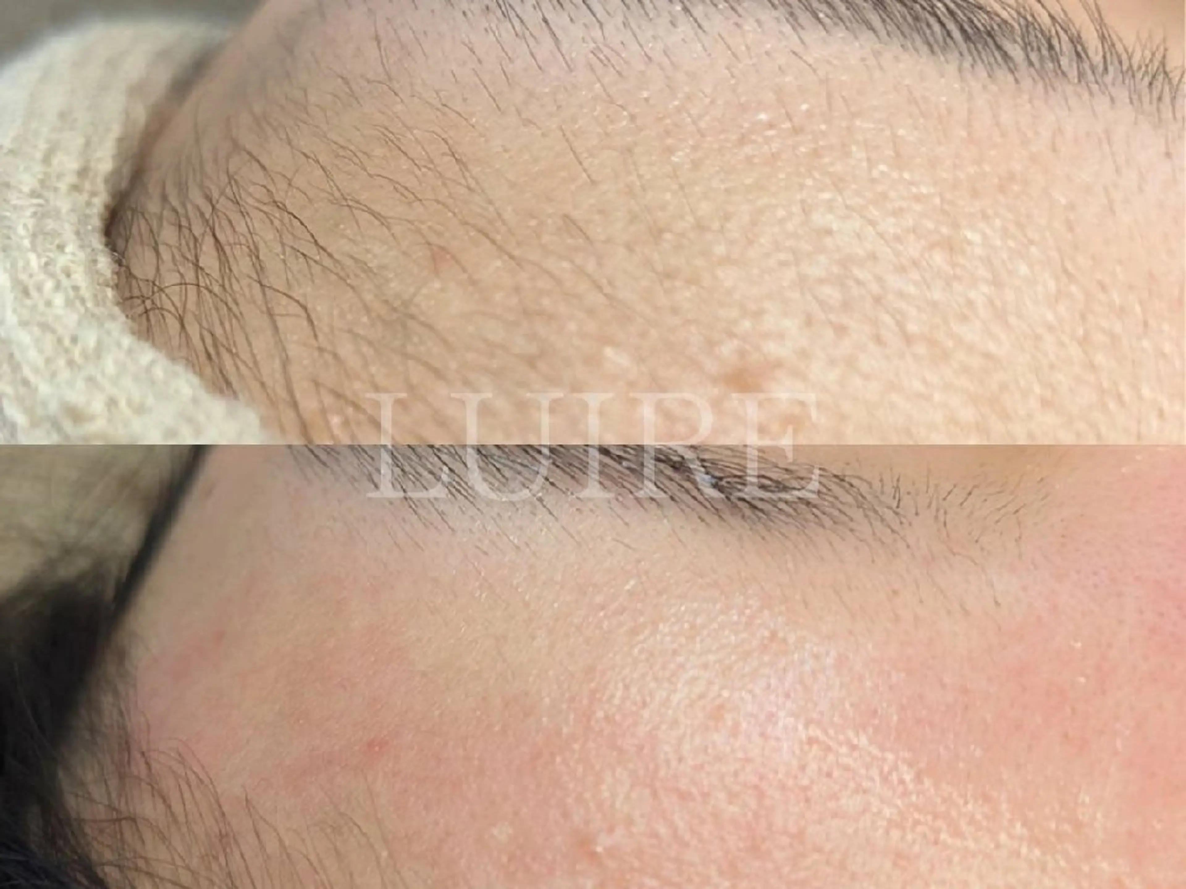 脱毛 Facial Salon LUIRE所属・LUIRE　 ルイールのエステ・リラクイメージ