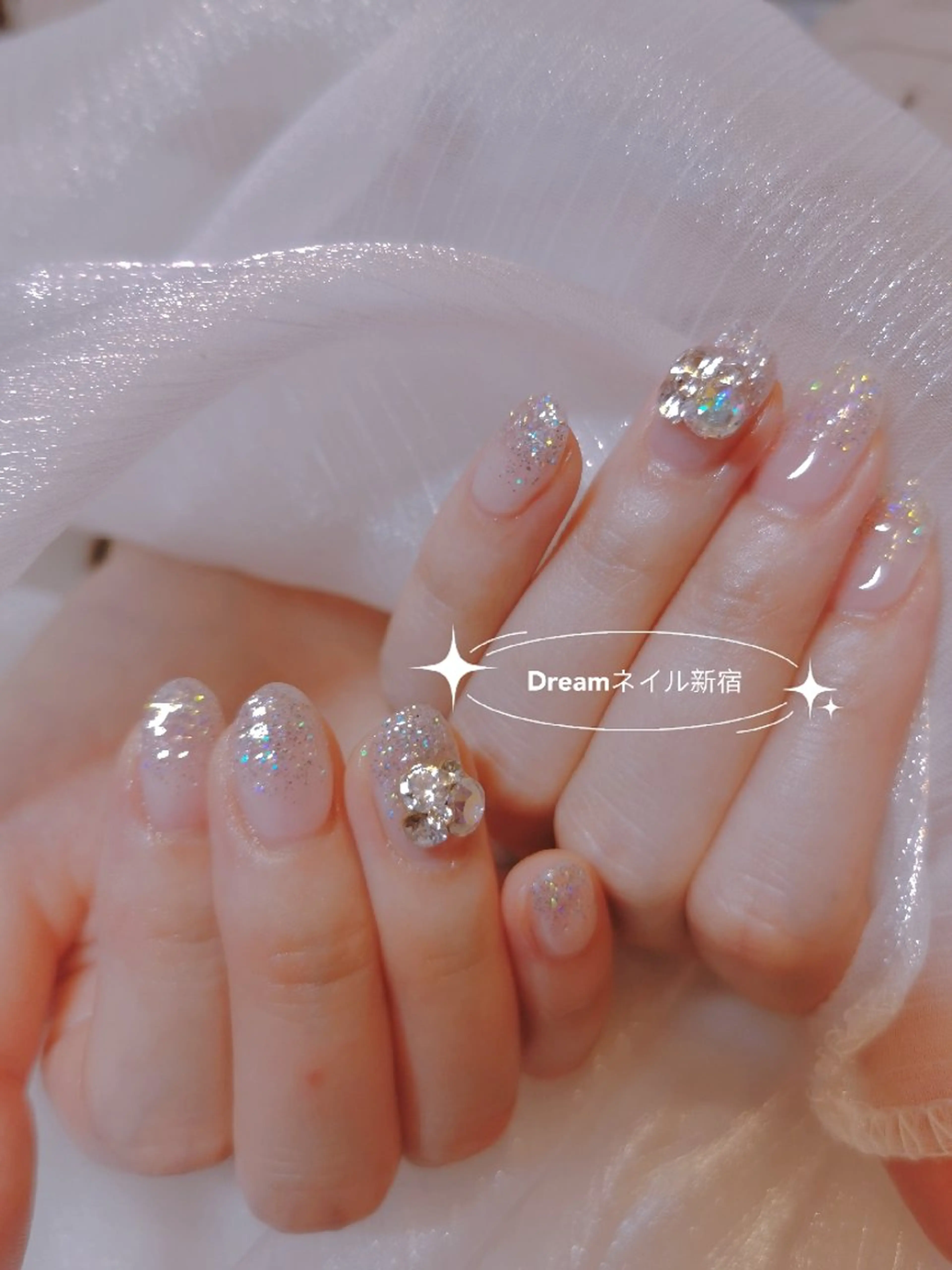 ネイル ハンドネイル ネイリストゆか💅 長さだし、深爪矯正のネイルデザイン