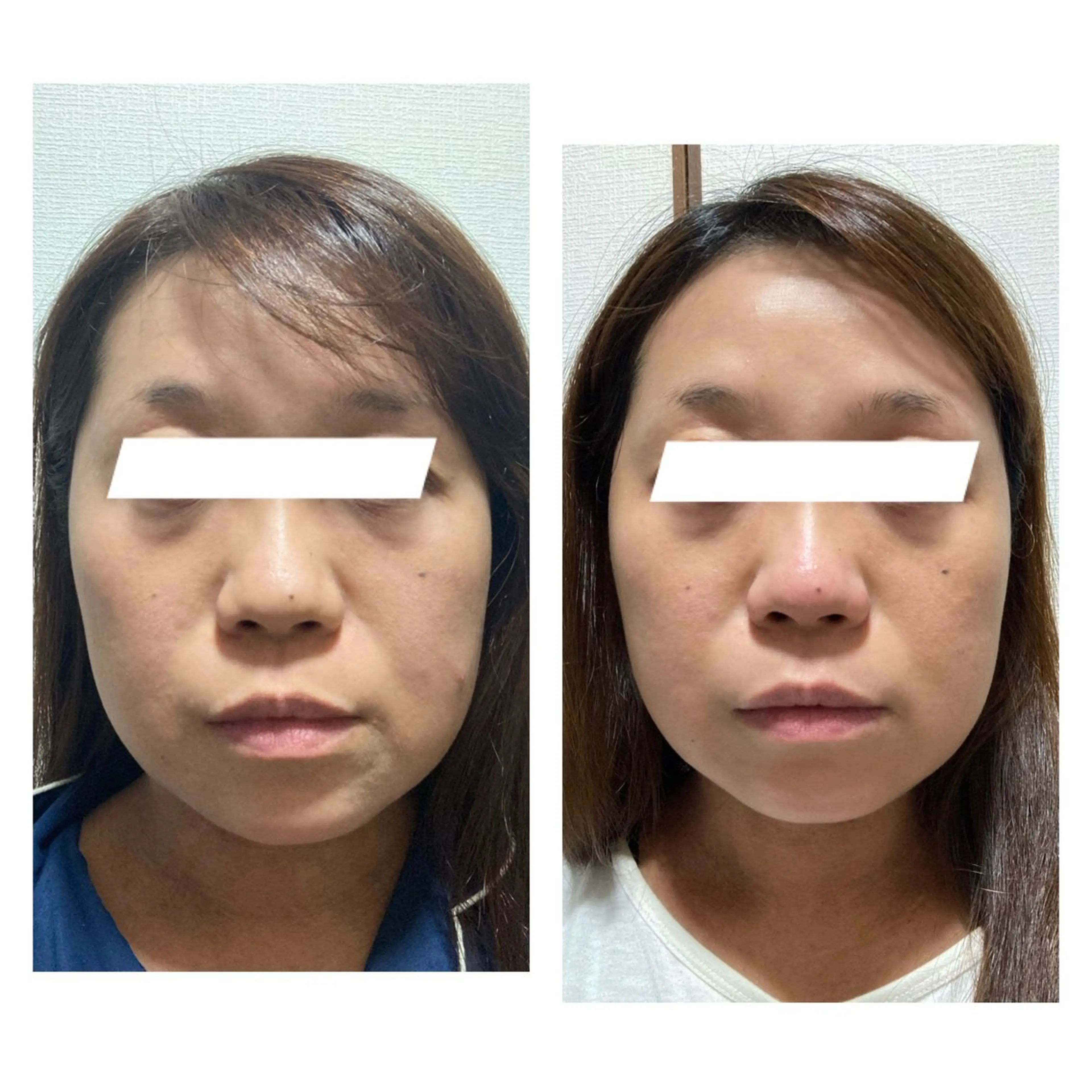 エステ ポテンツァ&針美容 バストアップ専門店のエステ・リラクイメージ