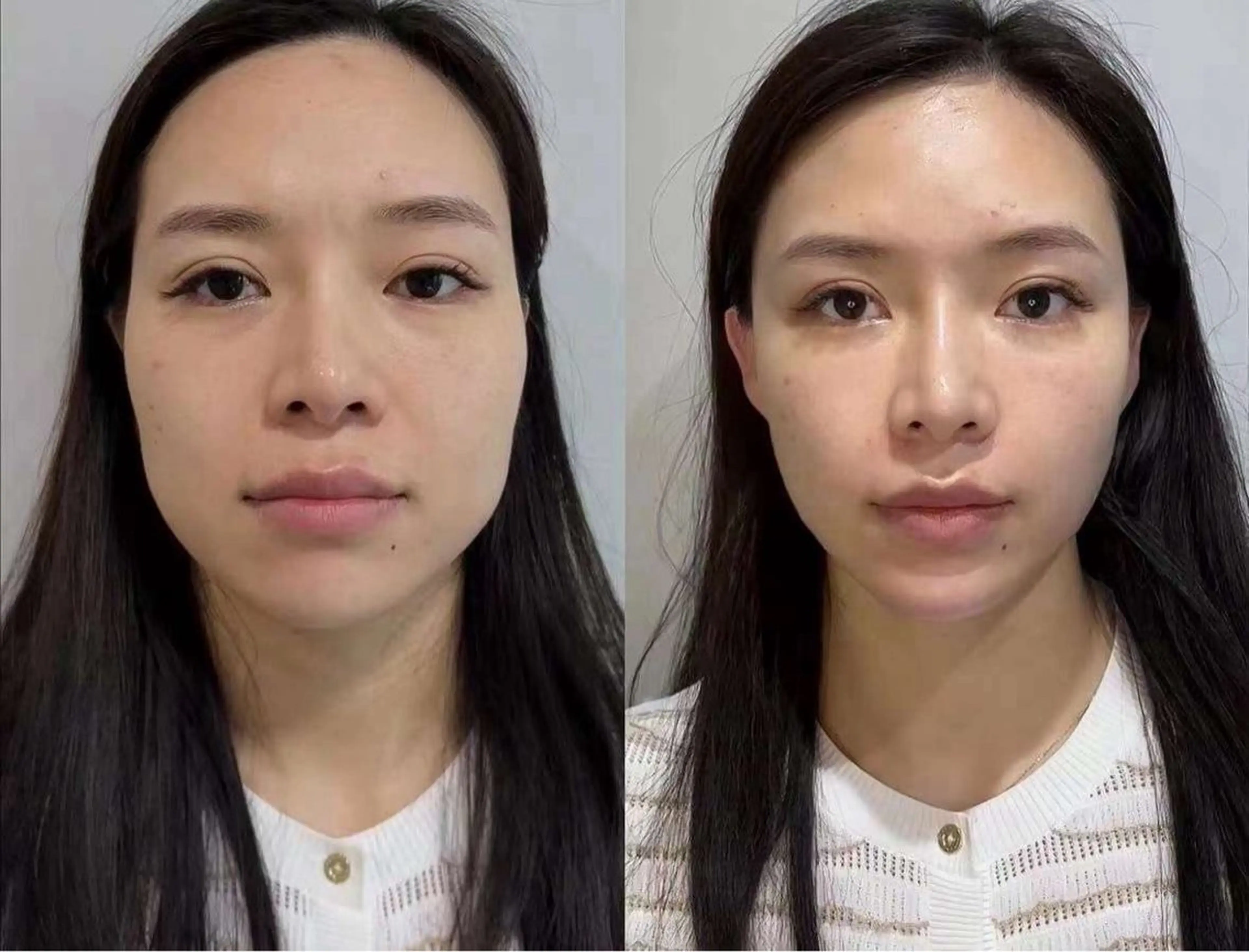 アイブロウ エステ 愛維美水光美肌専門店所属・愛維美水光美肌専門店 メンズレディースokのエステ・リラクイメージ