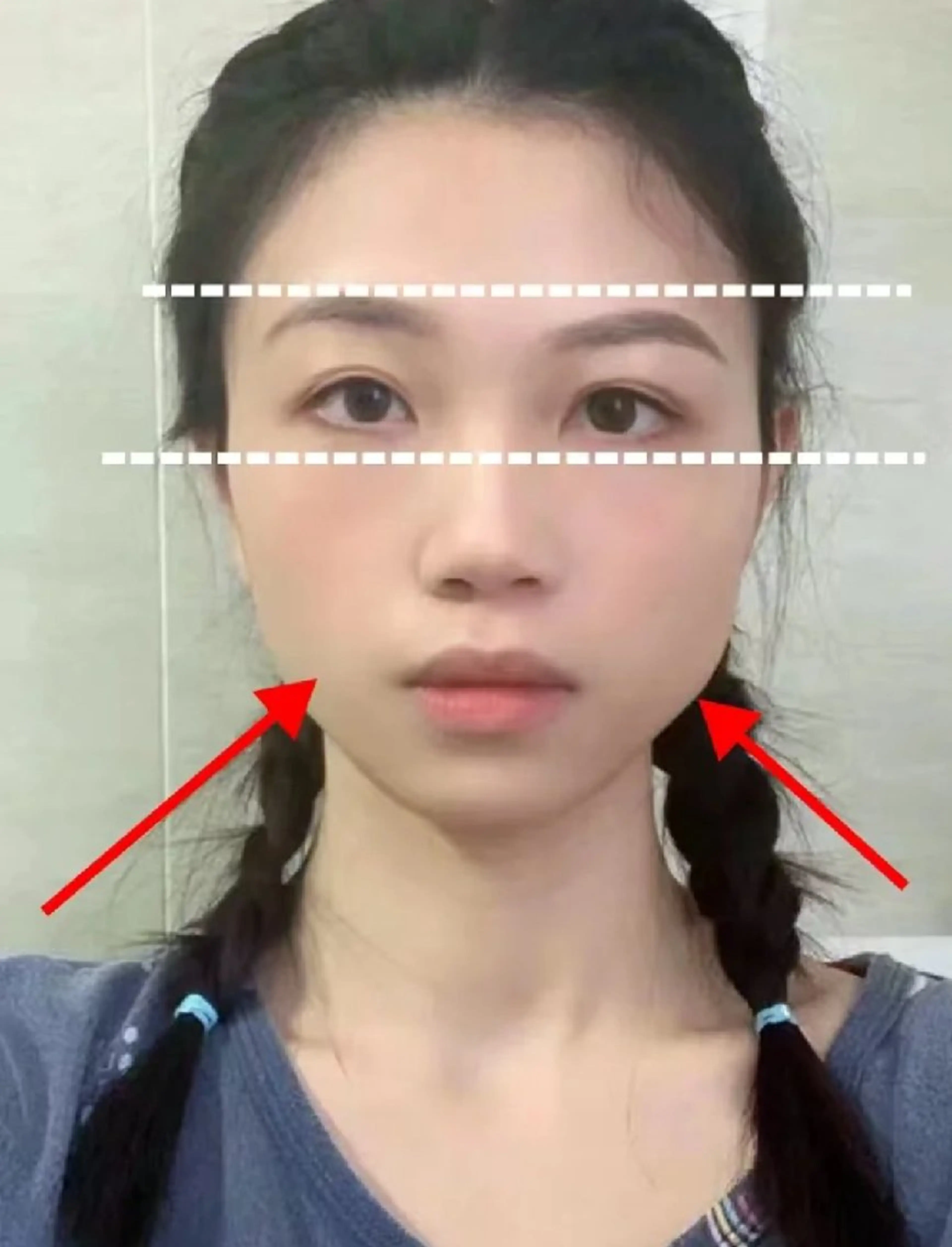 エステ aliaハイフ&水光ジェットサロン所属・aliaハーブ水光店 エステティシャン募集のエステ・リラクイメージ