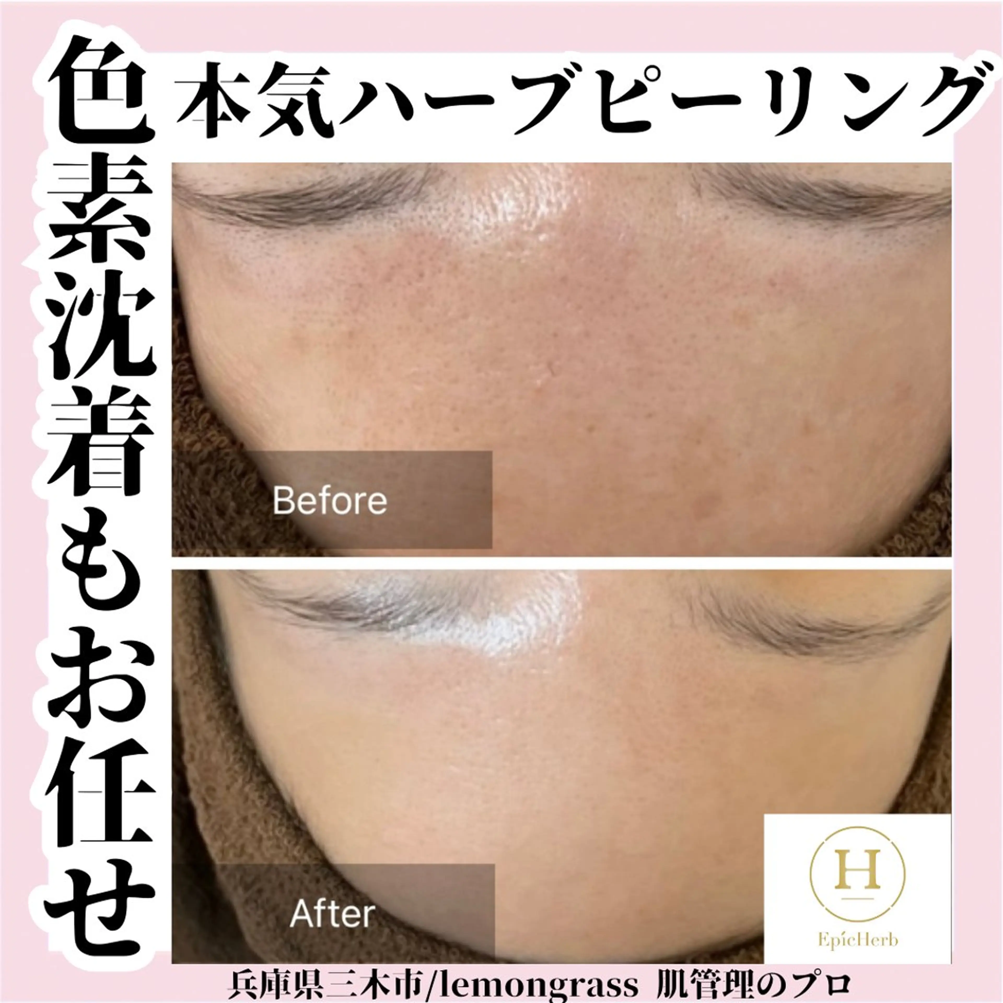 エステ ハーブピーリング 専門／今榮麻美のエステ・リラクイメージ