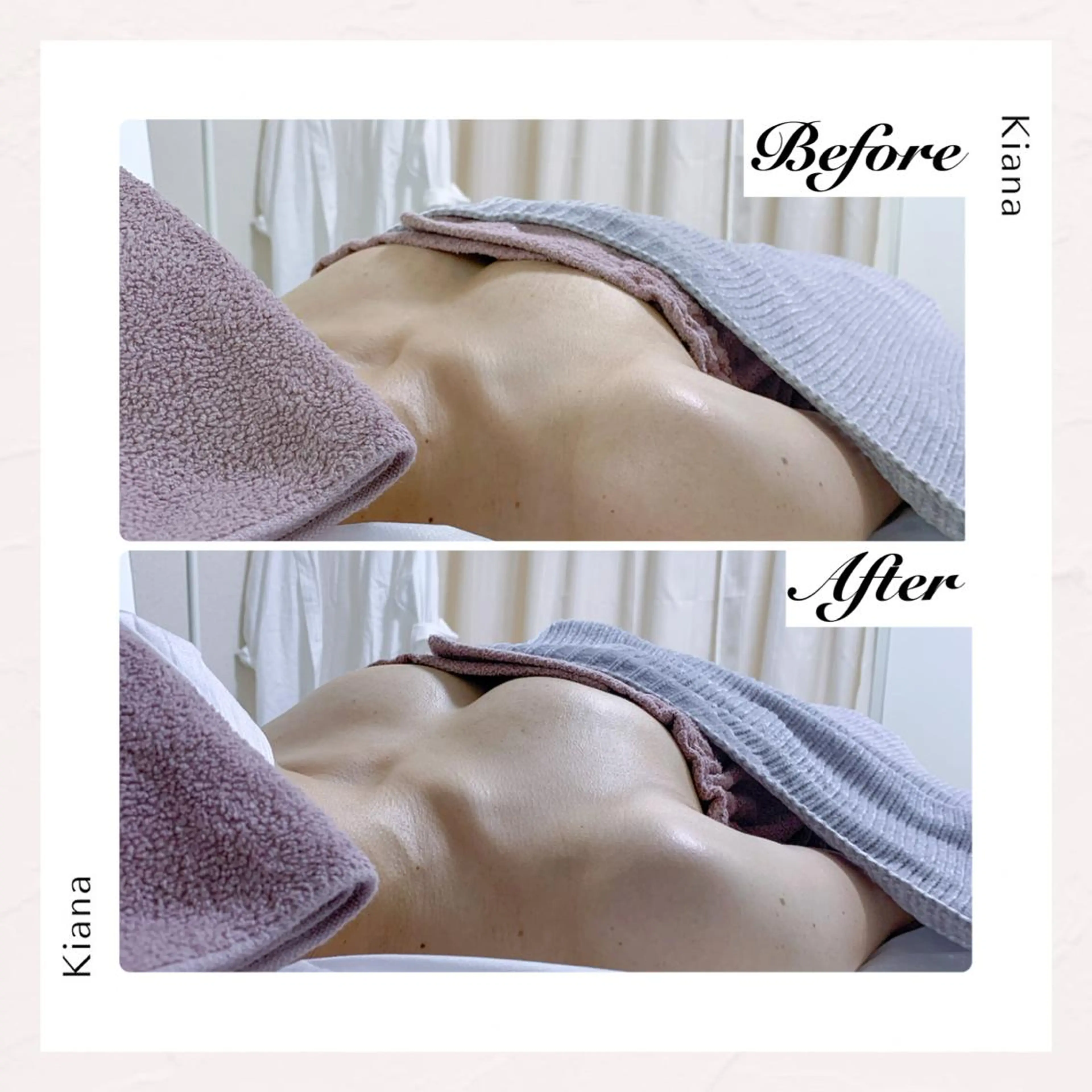 バスト専門Kiana 風のエステ・リラクイメージ