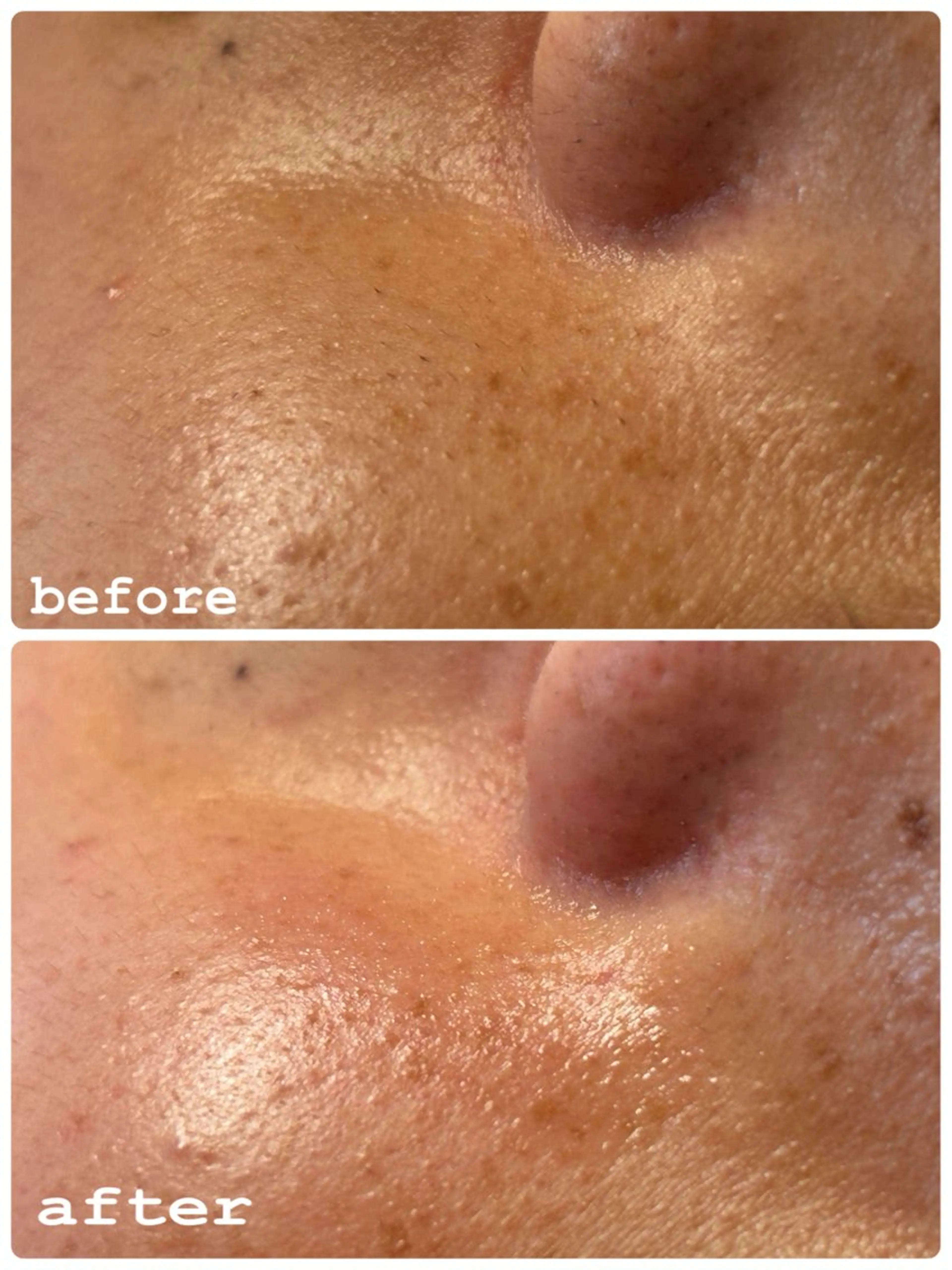 その他 sourire.11 ‪☺︎‬‪emiのエステ・リラクイメージ