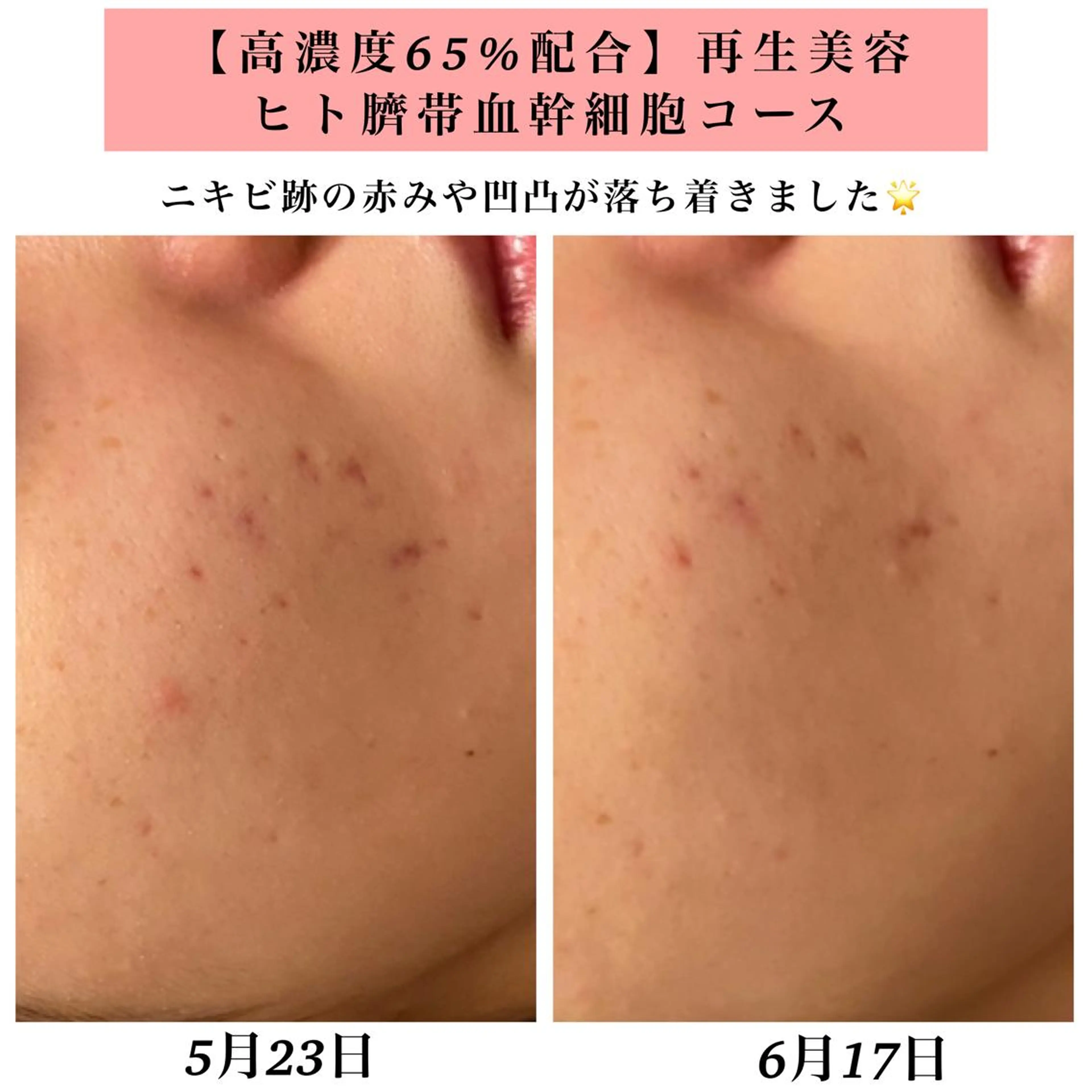 エステ リラク Bellesthe (ベルエステ)のエステ・リラクイメージ