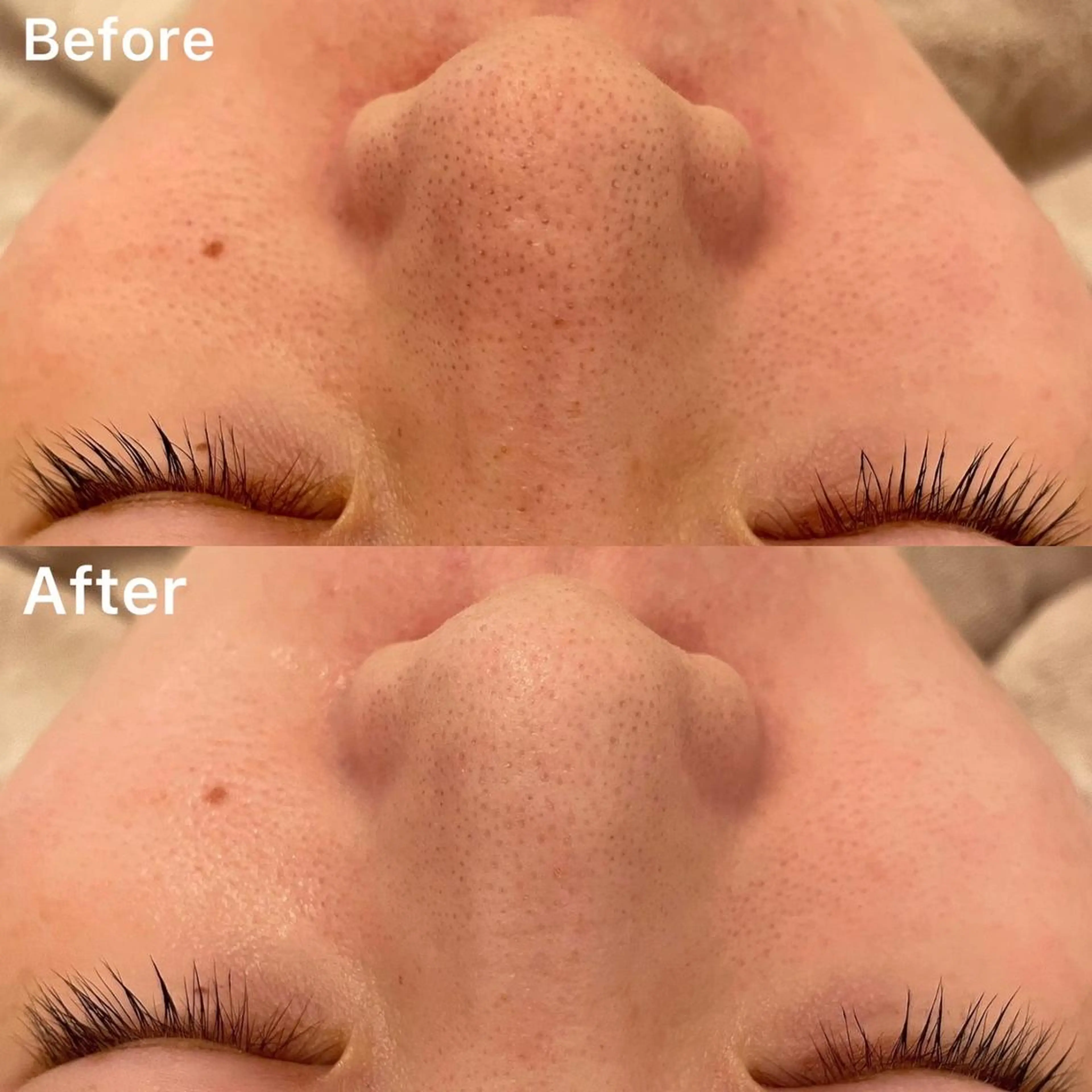 ✨美肌水光✨ アトリエリュバンのエステ・リラクイメージ