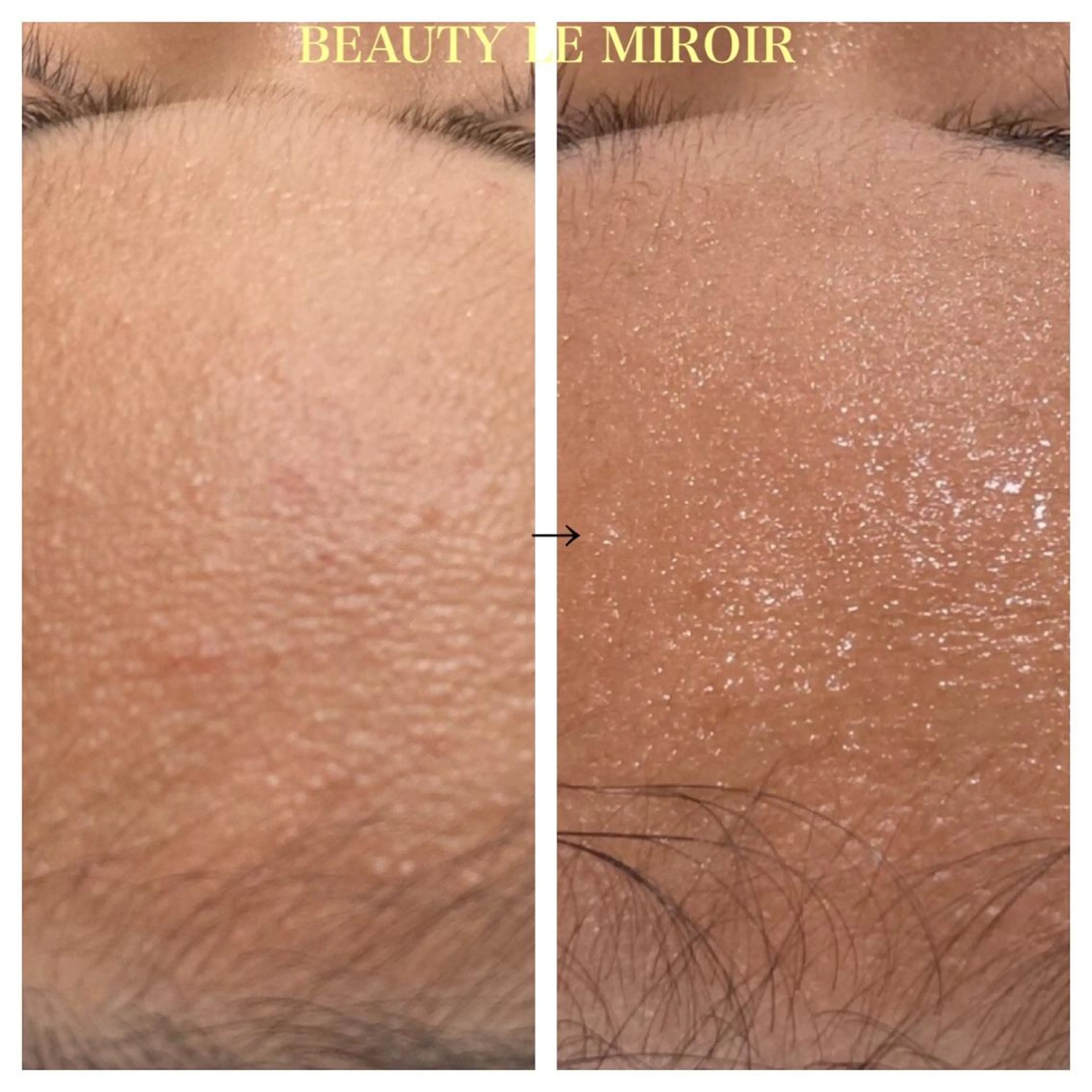 ビューティー ミロワールのエステ・リラクイメージ