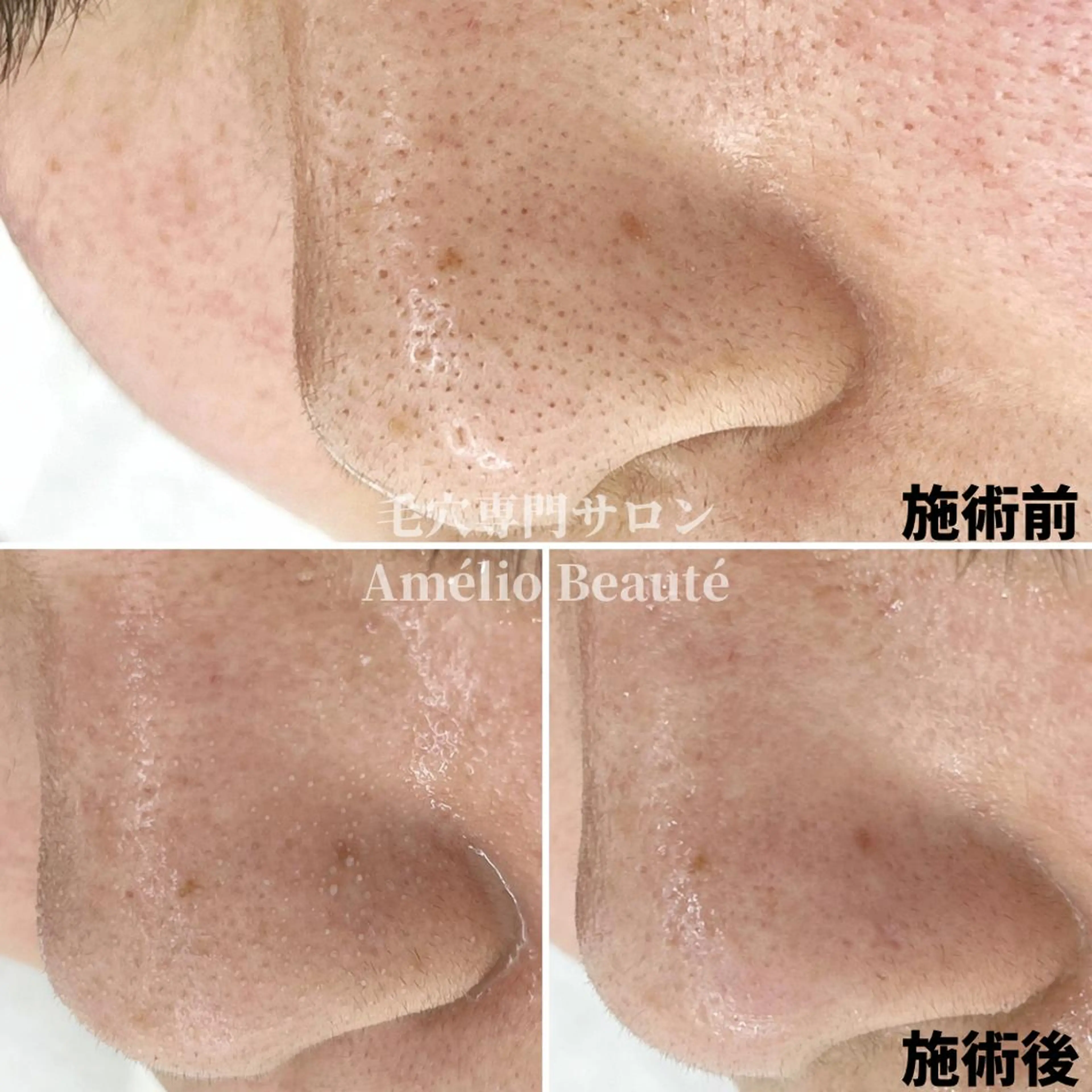 毛穴ケア専門サロン Amélio Beauté所属・毛穴ケア専門サロン アメリオボーテのその他イメージ