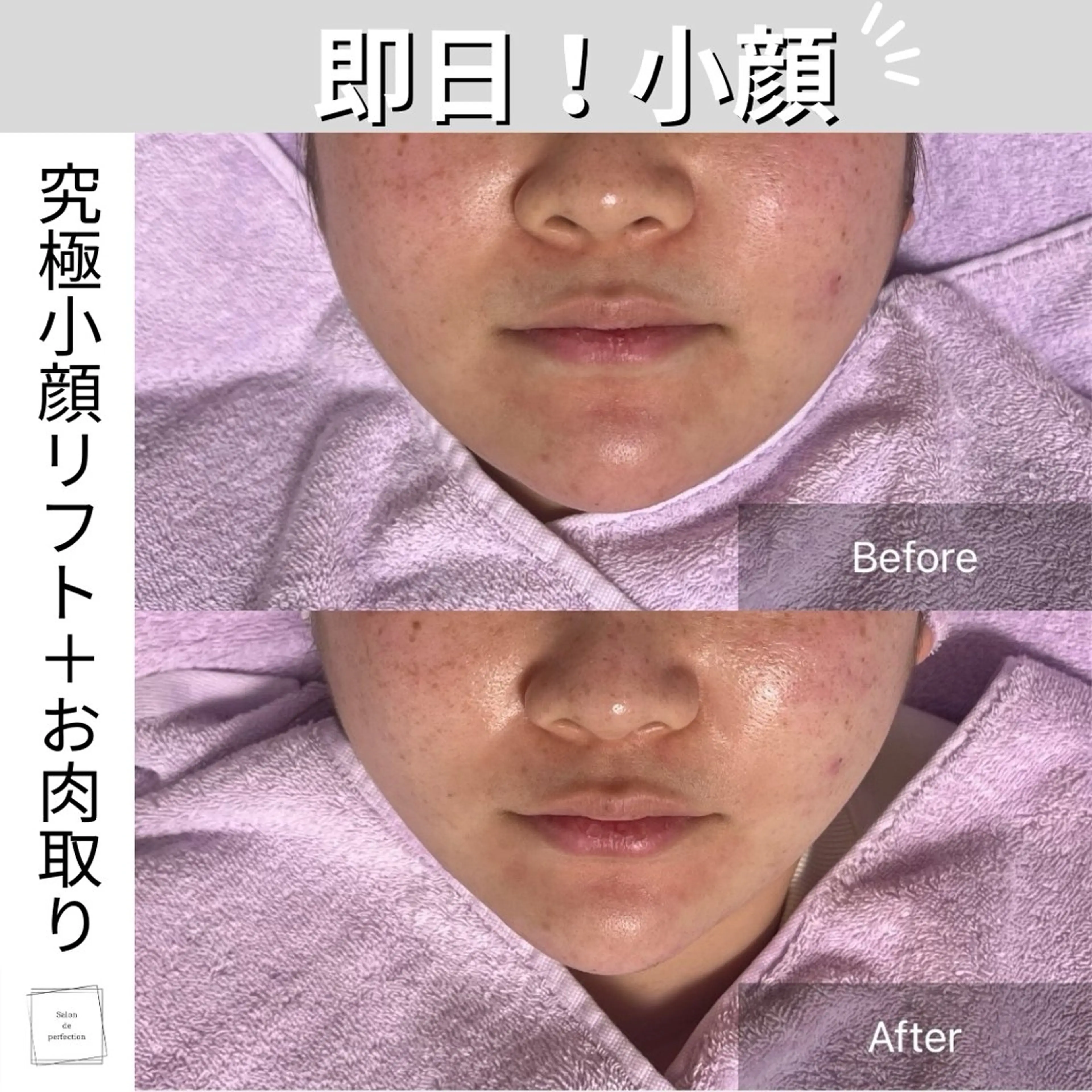 エステ salon de perfectionのエステ・リラクイメージ