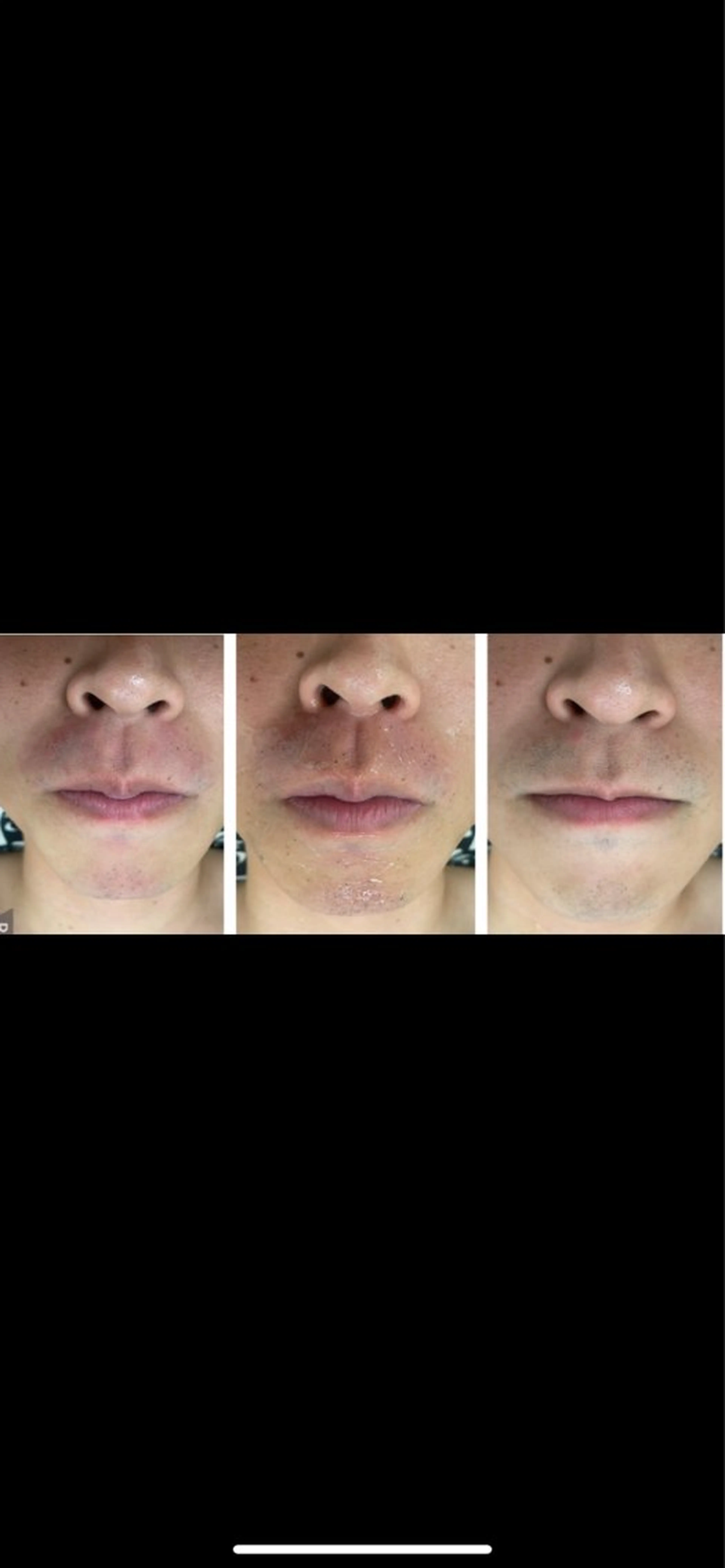 メンズ RE:moom リムーム/脱毛エステのエステ・リラクイメージ