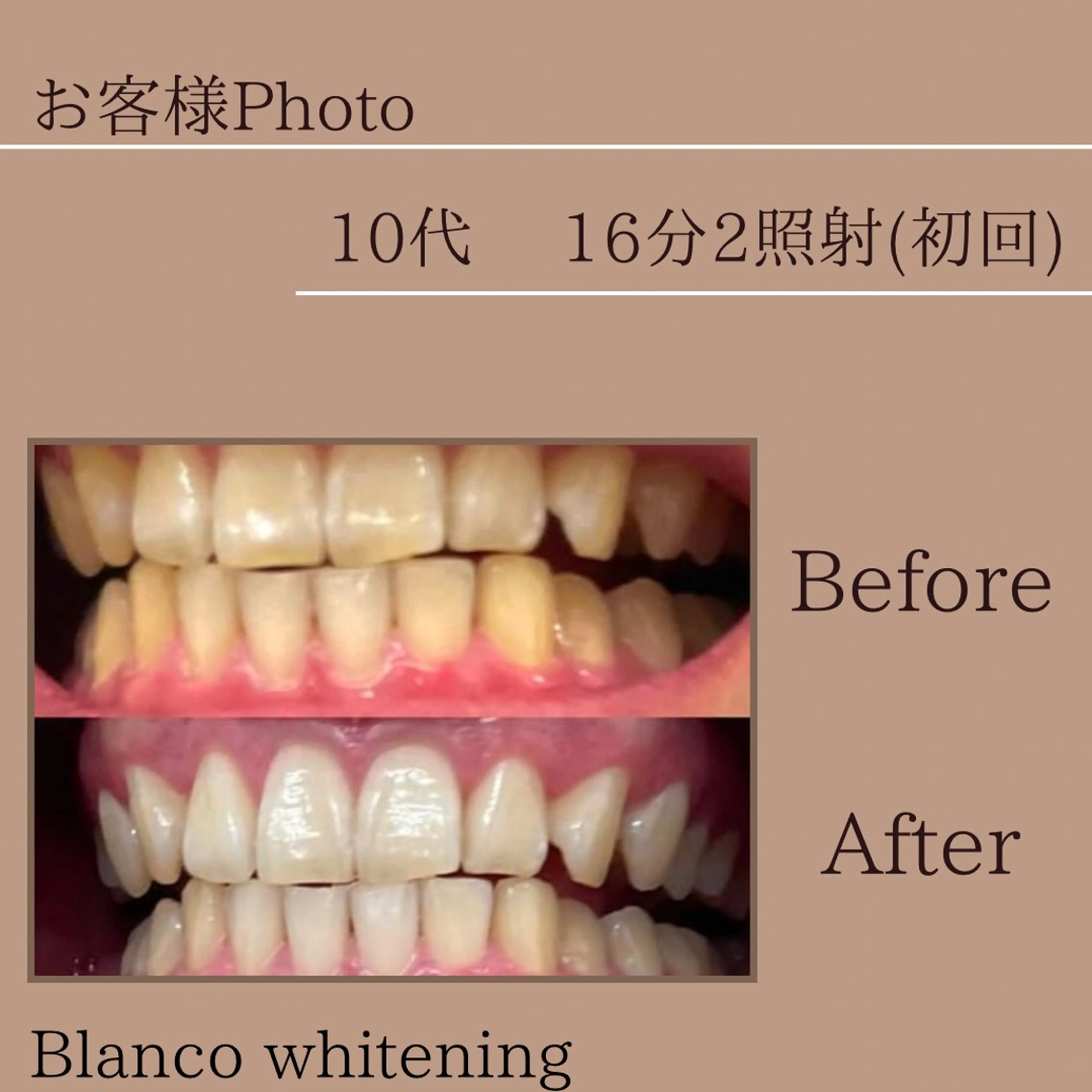 Blanco東大宮駅前店所属・blanco 東大宮駅前店のその他イメージ