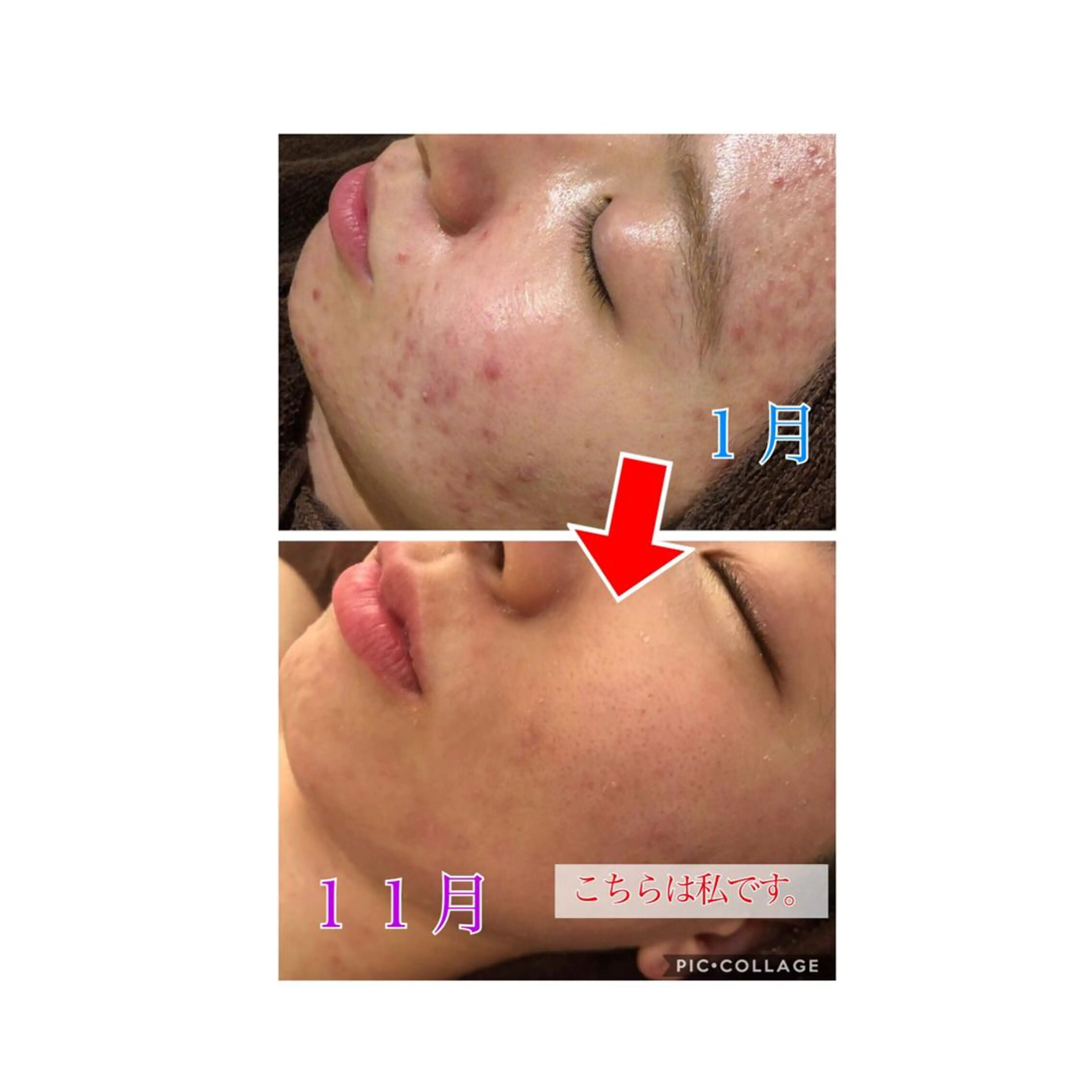 セミロング カラー パーマ ヘアアレンジ メンズ キッズ ネイル マツエク・マツパ 四つ星サロン🎖 腸＆ニキビケアに特化のエステ・リラクイメージ