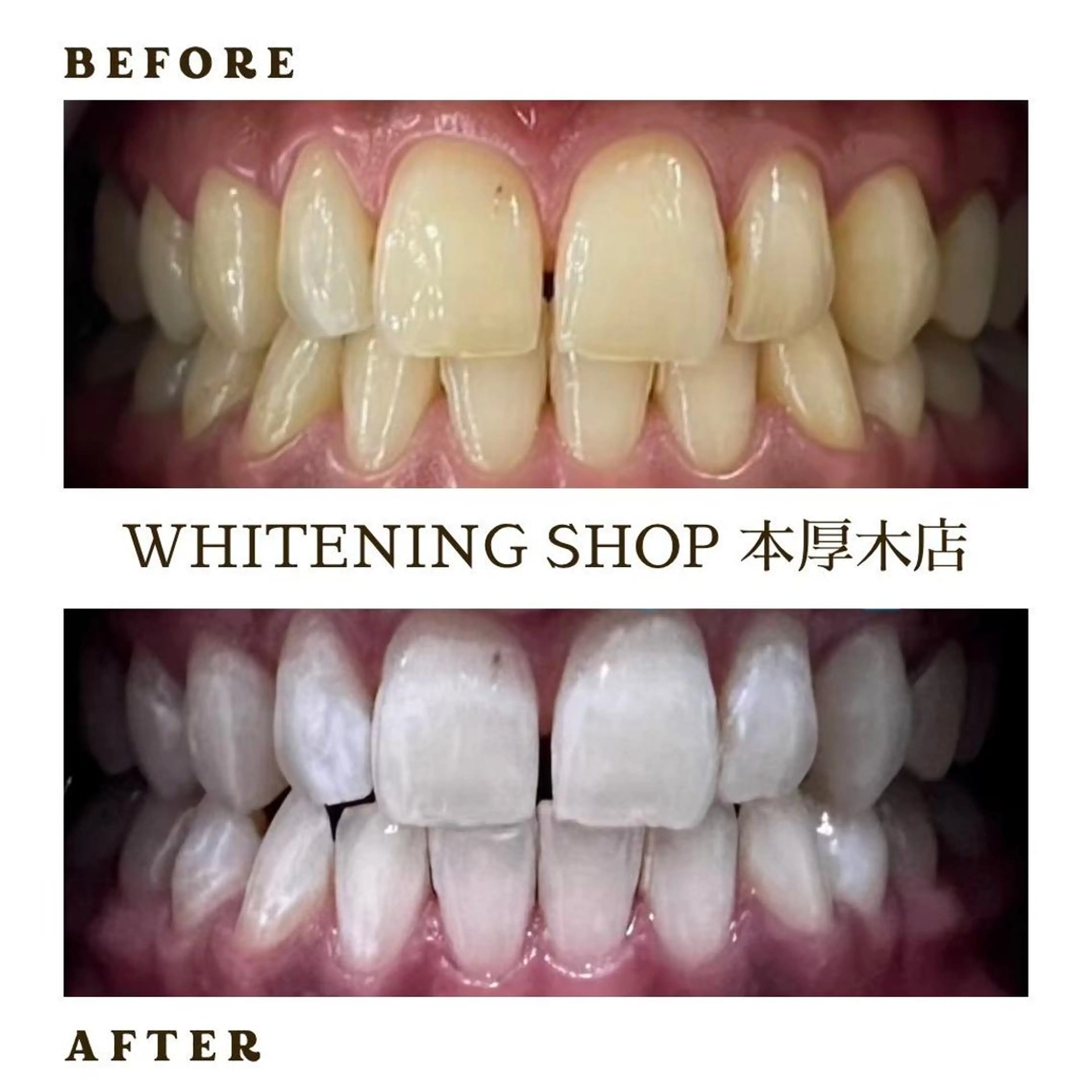 メンズ その他 ホワイトニング ショップ本厚木のその他イメージ